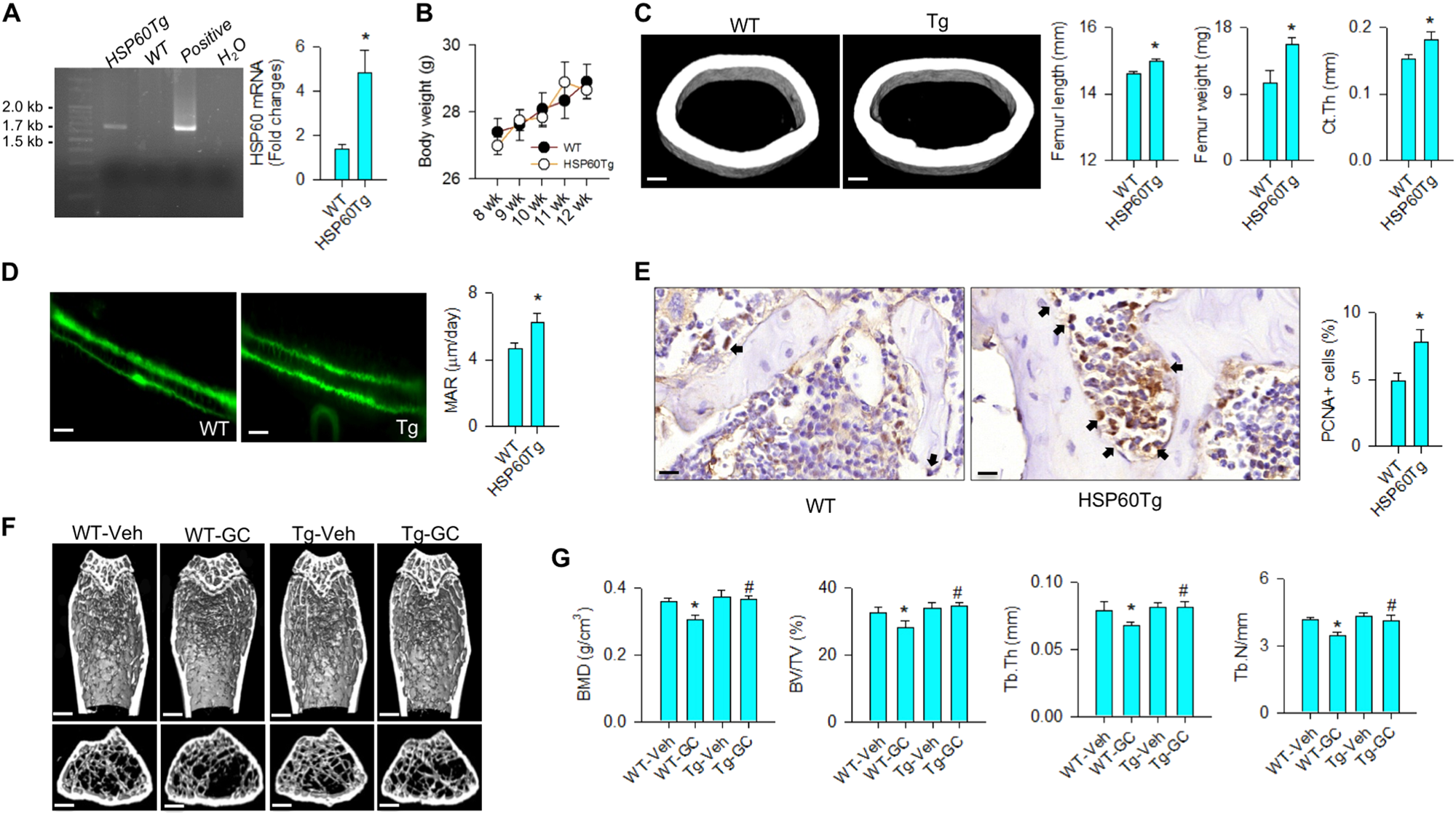 Fig. 6: Analyses of bone mass and microstructure of HSP60Tg mice.