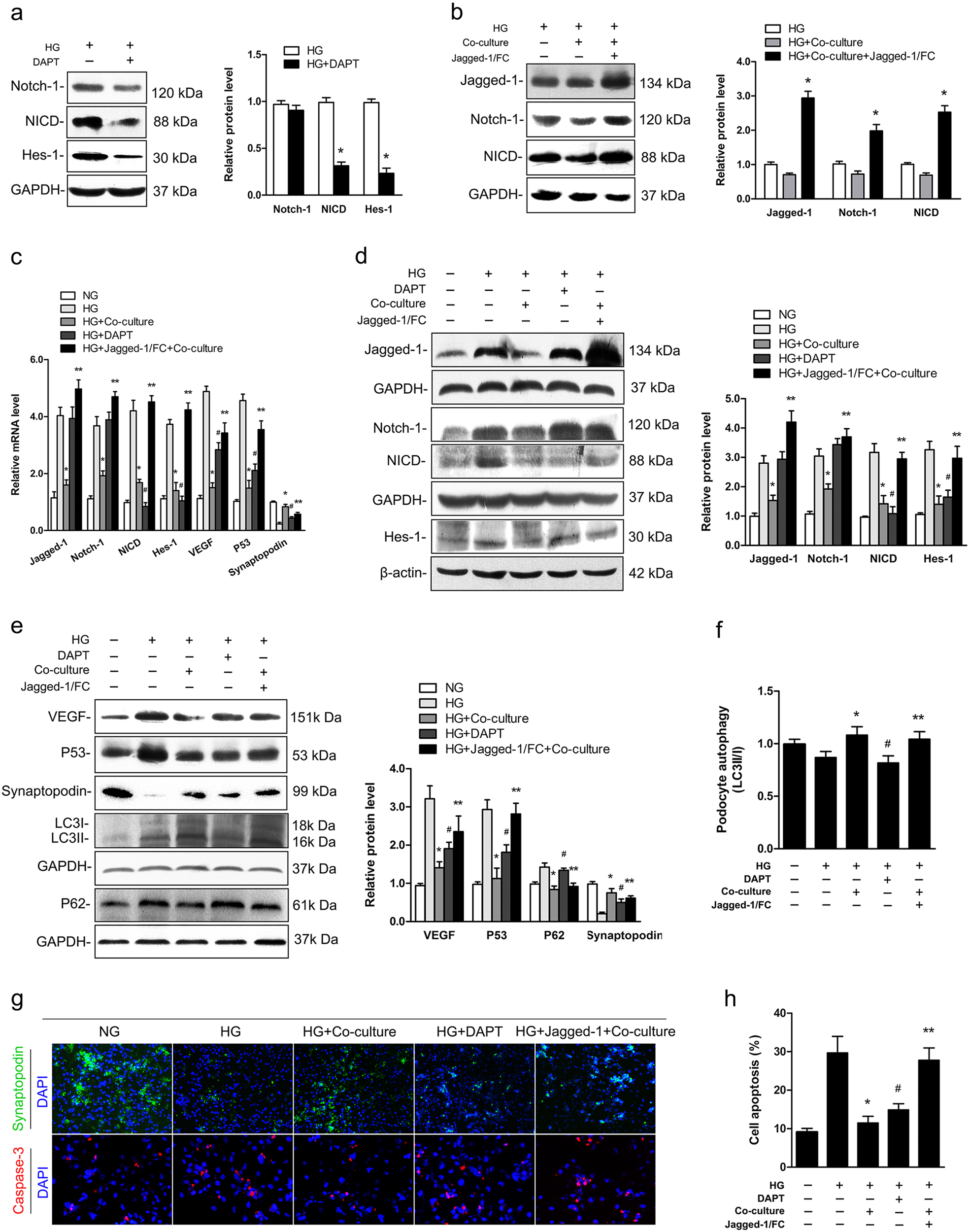 Fig. 2: Highly activated Notch-1 signaling weakened the protective efficacy of co-cultured islets under HG condition in vitro.