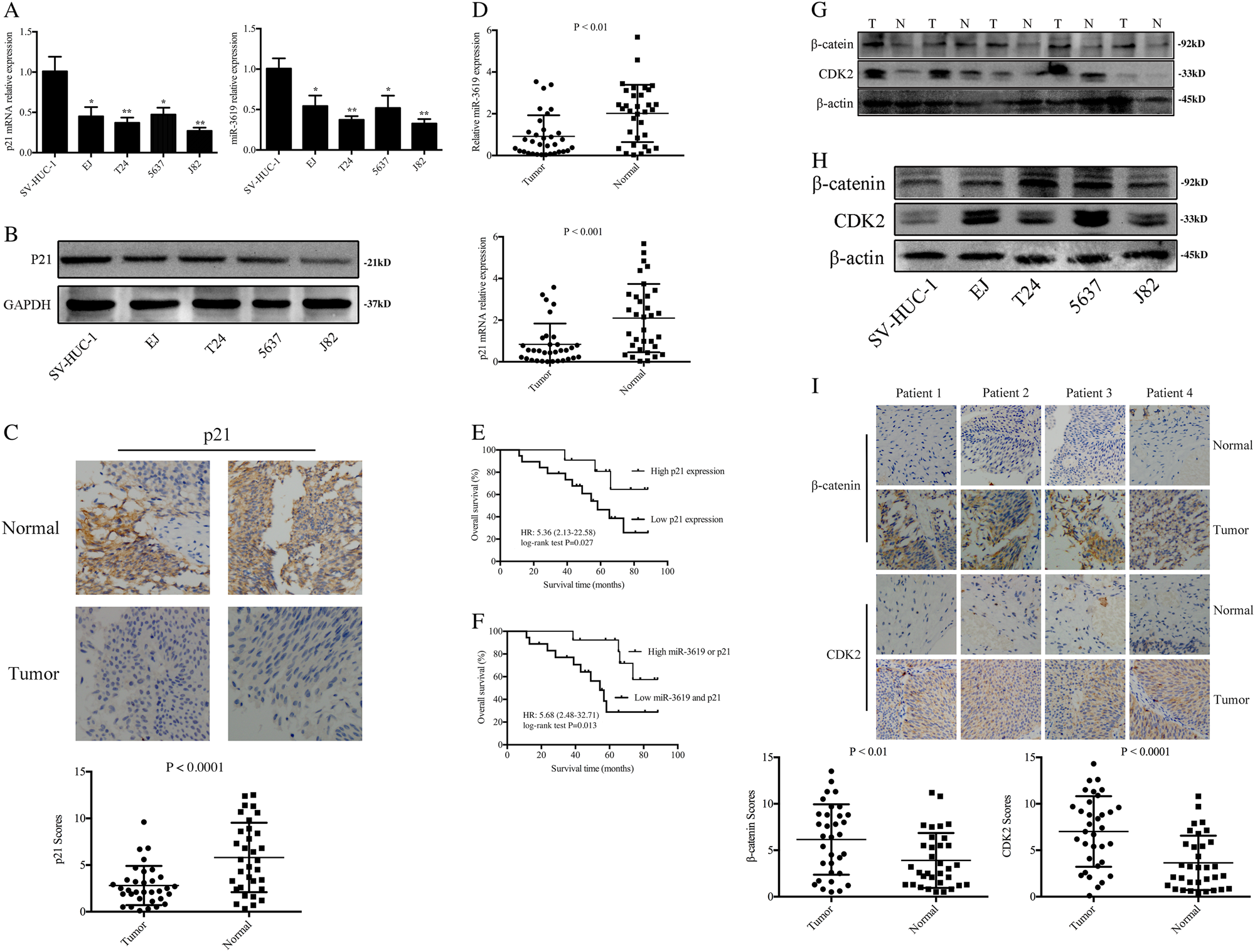Fig. 1: The expression of miR-3619 and p21 as well as β-catenin and CDK2 are detected in BCa cells and tissues.
