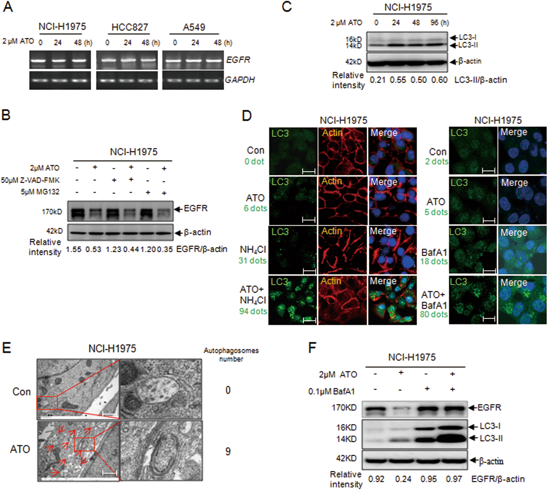 Fig. 2: Arsenic-induced autophagy in NSCLC cells.