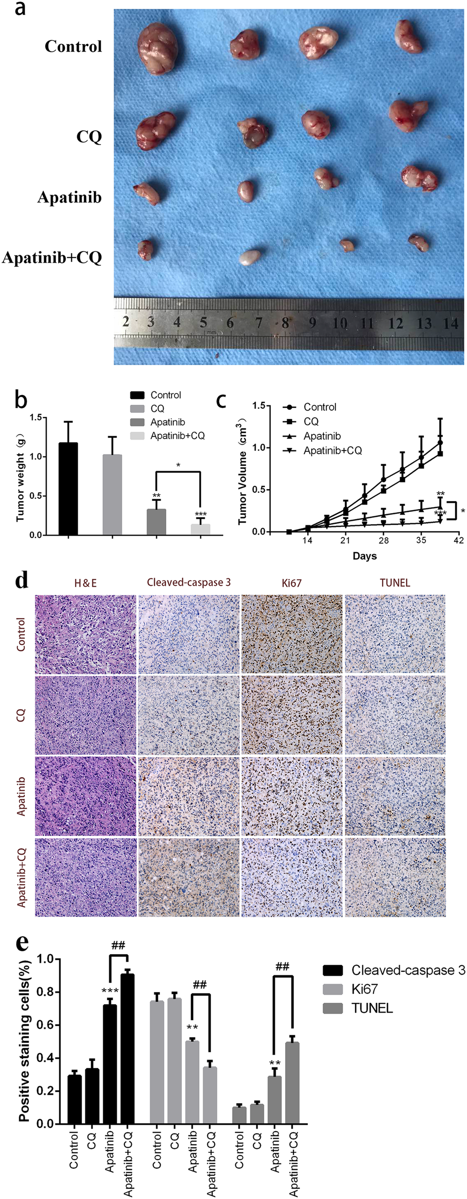 Fig. 6: Inhibition of tumor growth in vivo by apatinib and CQ.