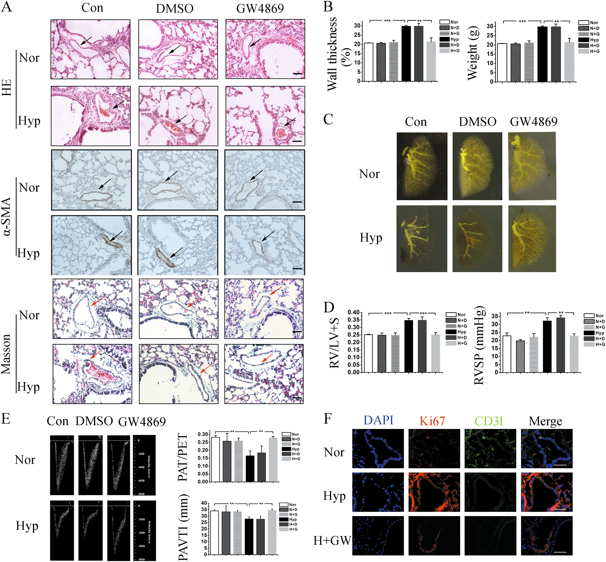 Fig. 2: GW4869 reversed the progression of PH induced by hypoxia.