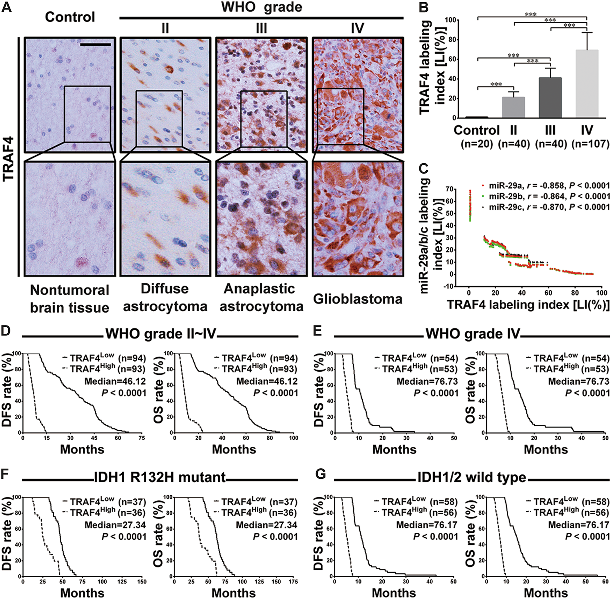 Fig. 4: TRAF4 expression is associated with glioma grade, miR-29a/b/c levels and patient prognoses.