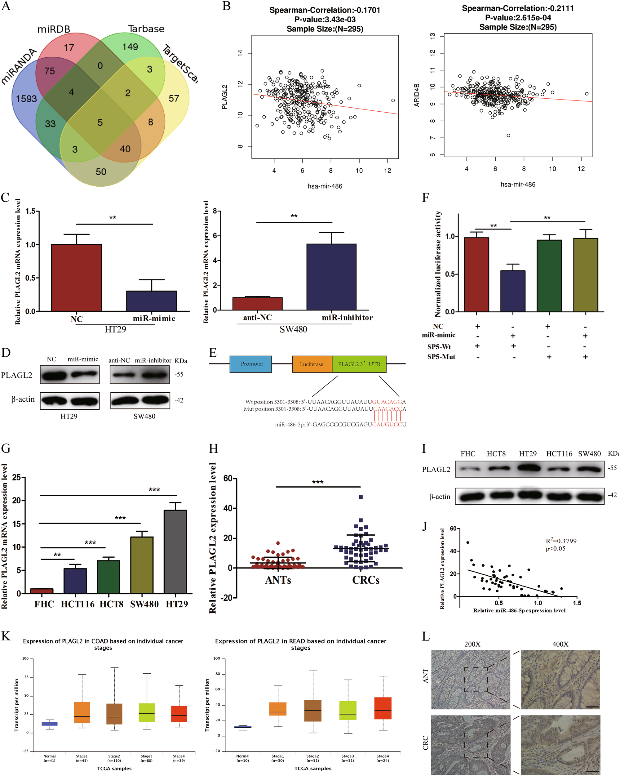 Fig. 5: PLAGL2 PLAGL2 is a direct target of miR-486-5p and upregulated in CRC tissues and cell lines.
