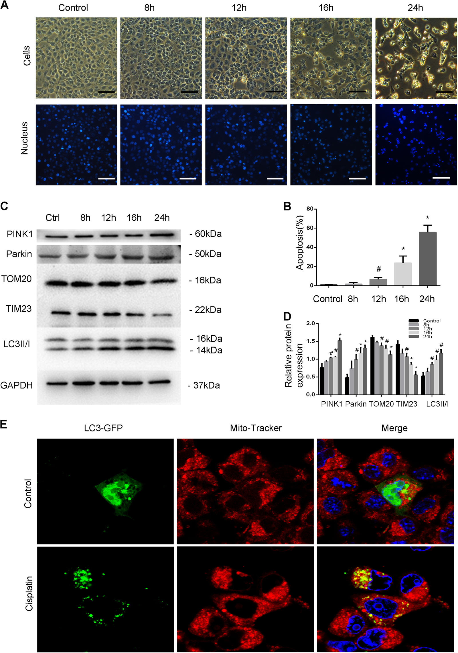 Fig. 1: PINK1/Parkin-mediated mitophagy is induced during cisplatin treatment in BUMPT cells.