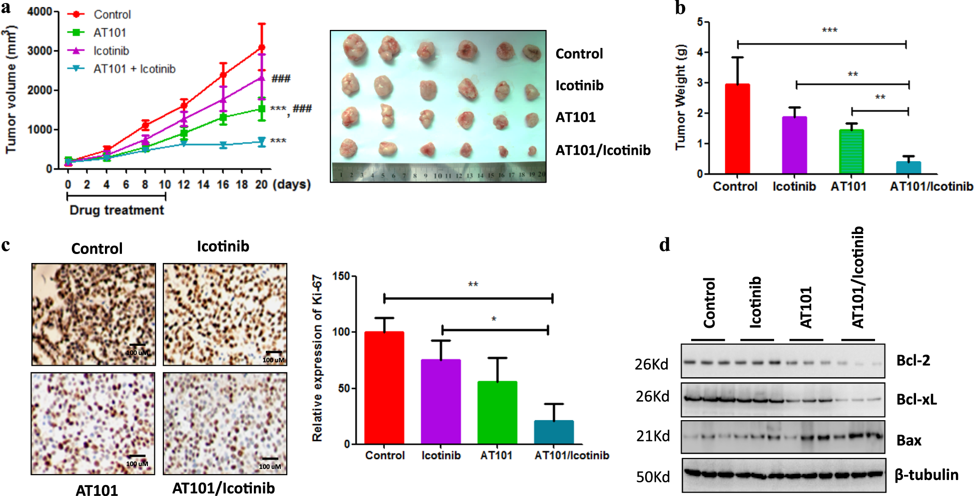 Fig. 4: Combination treatment of Icotinib and AT101 dramatically inhibited TKI-resistant tumor growth in a xenograft model.
