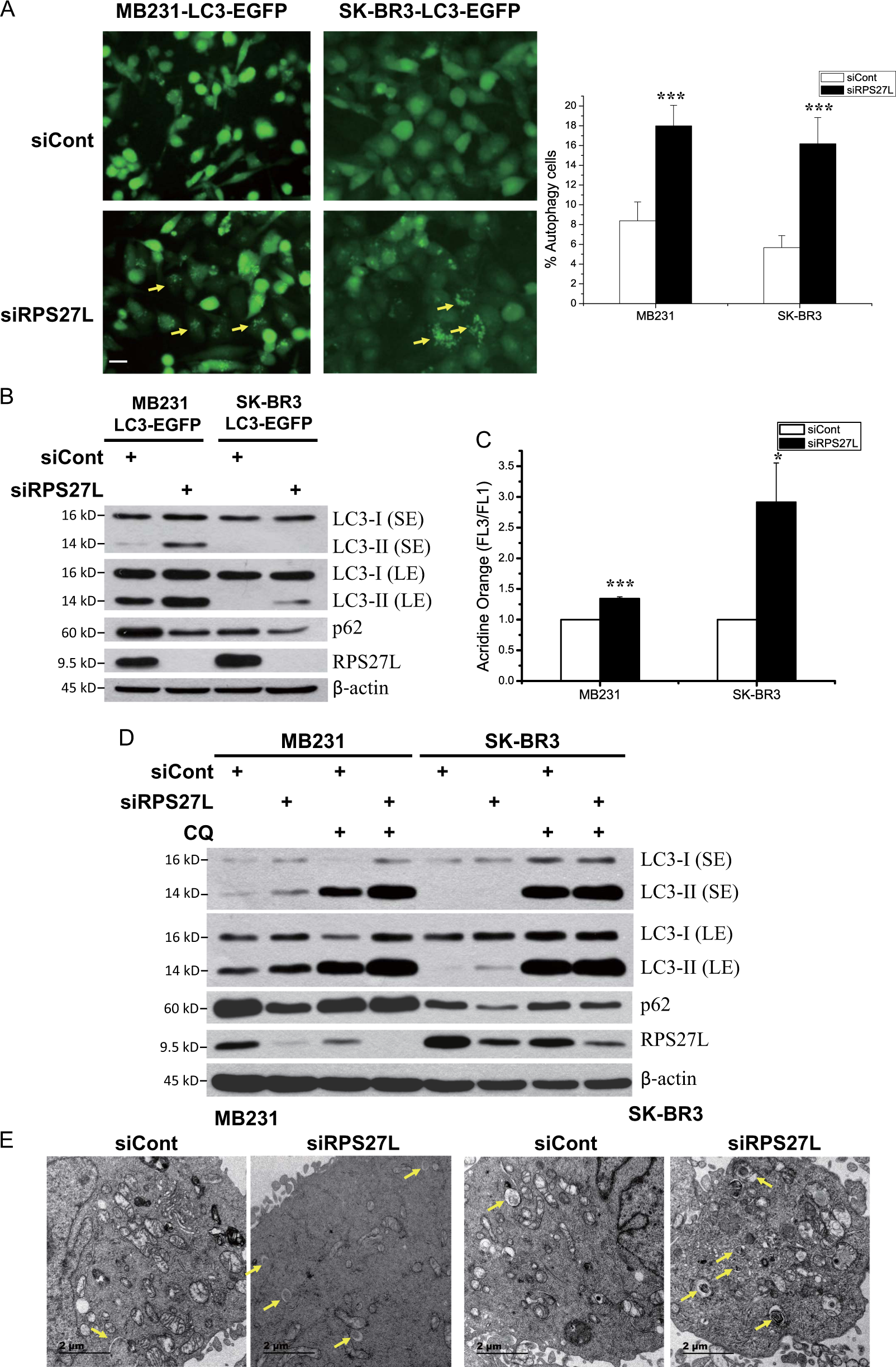 Ribosomal protein S27-like regulates autophagy via the β-TrCP-DEPTOR-mTORC1 axis | Cell Death & Disease