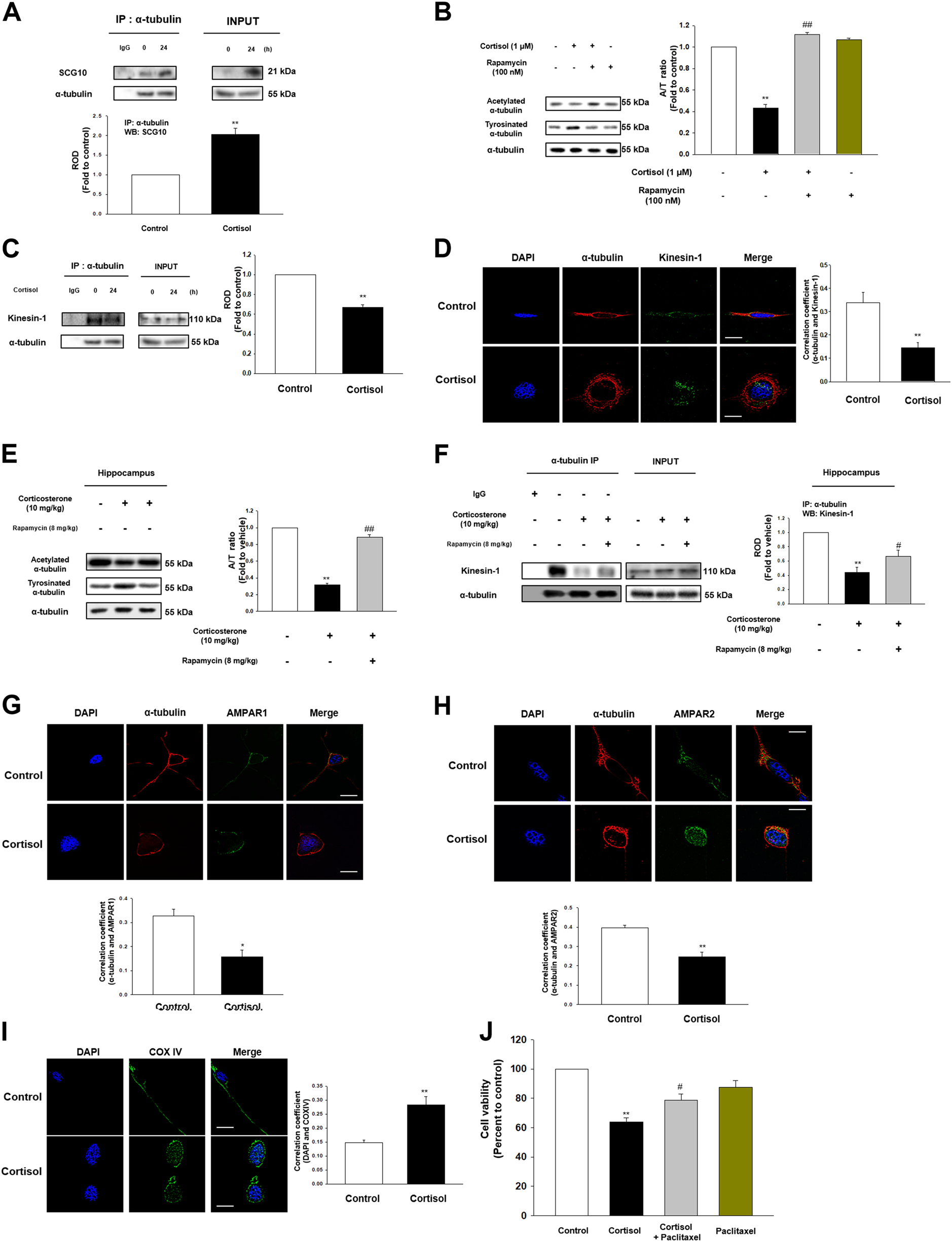 Fig. 5: Glucocorticoid promoted microtubule destabilization and following transport impairment.
