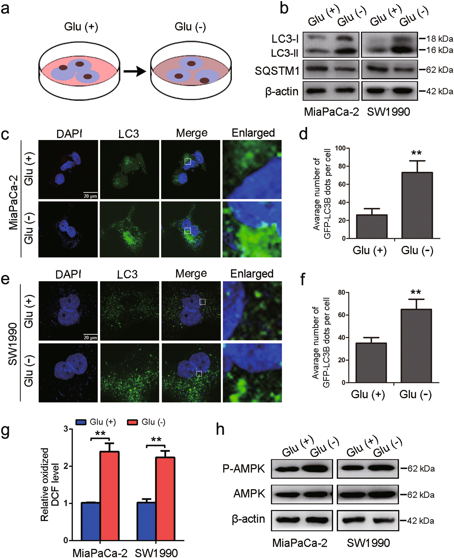 GPx1 is involved in the induction of protective autophagy in pancreatic cancer cells in response to glucose deprivation | Cell Death & Disease GPx1 is involved in the induction of protective autophagy in pancreatic cancer cells in response to glucose deprivation | Cell Death & Disease