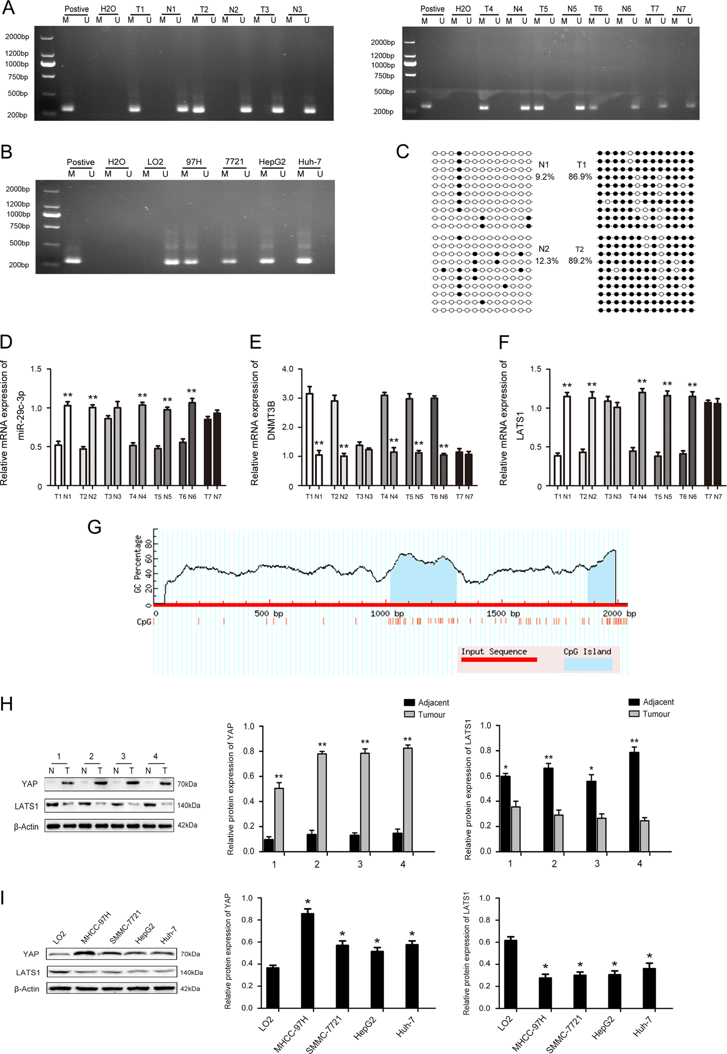Fig. 4: Aberrant DNA hypermethylation and expression of large tumor suppressor gene 1 (LATS1) in hepatocellular carcinoma (HCC) and HCC cell lines.