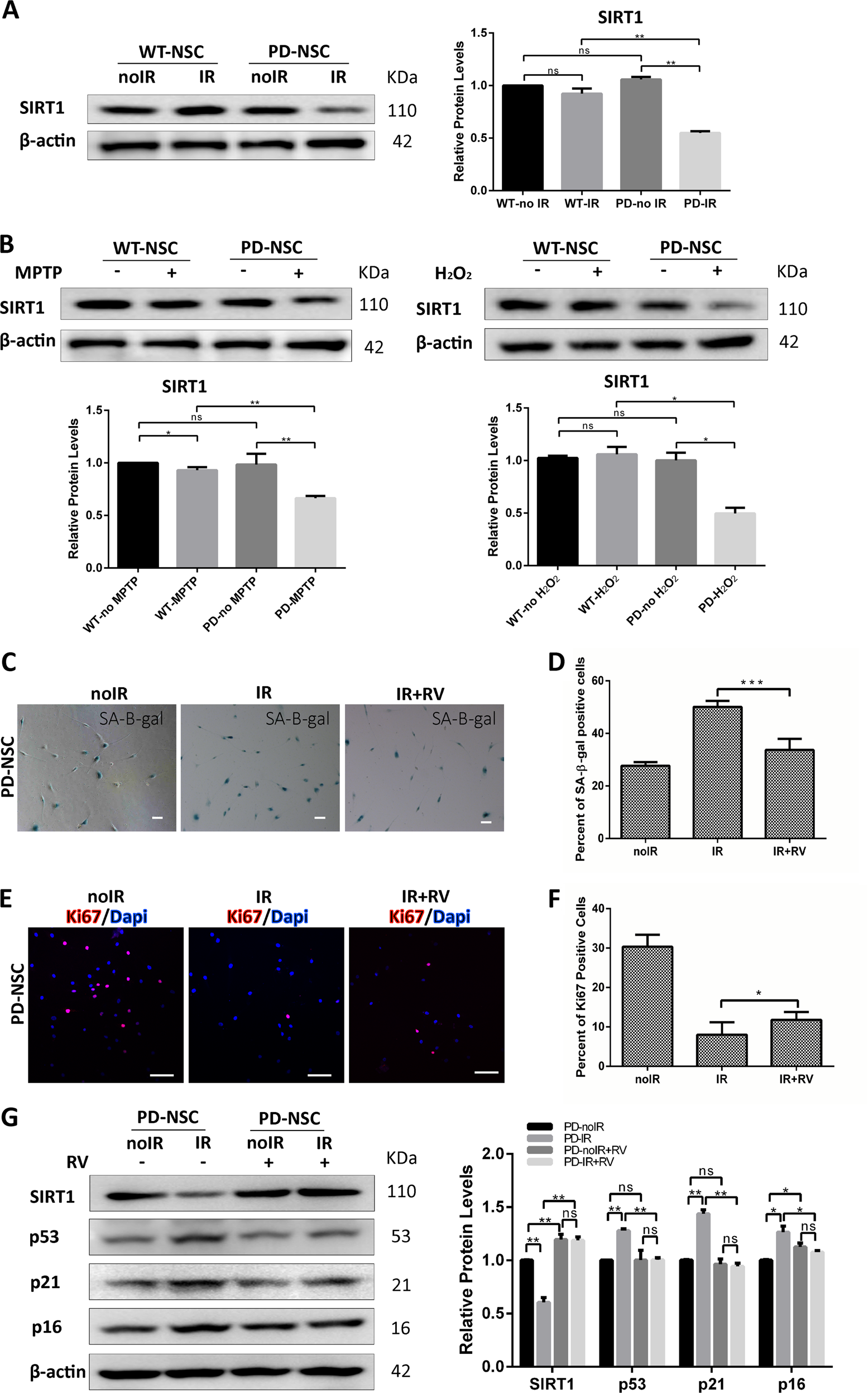 Fig. 2: SIRT1 was downregulated in PD-NSCs by various stresses, which was attributable for the premature aging phenotypes.