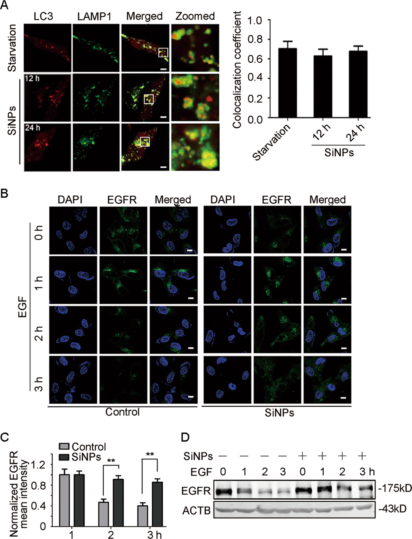 Fig. 5: SiNPs impair lysosomal degradative capacity.
