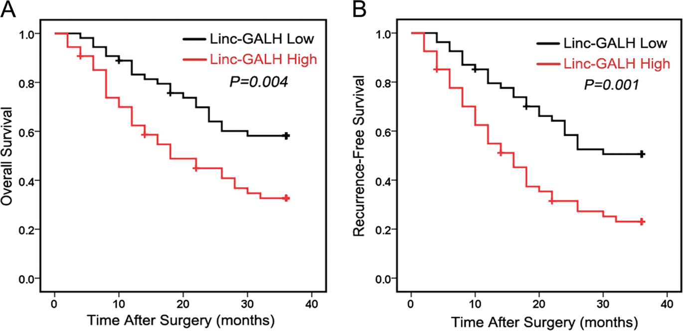Fig. 2: Linc-GALH expression is correlated with the prognosis of patients.