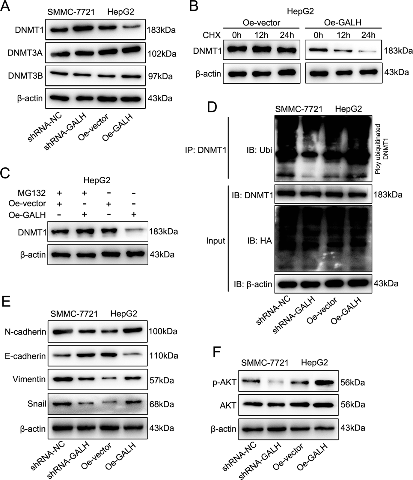 Fig. 7: Linc-GALH regulates the ubiquitination of DNMT1 and involves the regulation of AKT signaling.