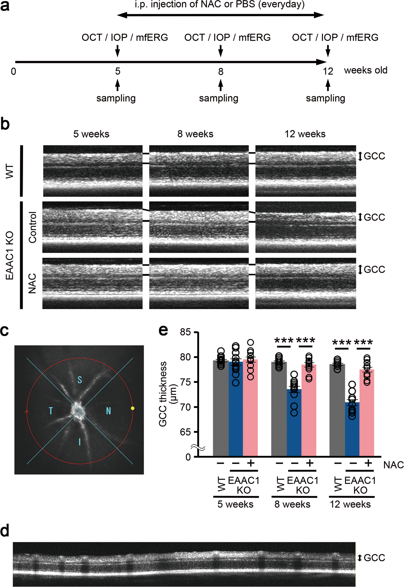 Differential effects of N-acetylcysteine on retinal degeneration in two  mouse models of normal tension glaucoma | Cell Death & Disease