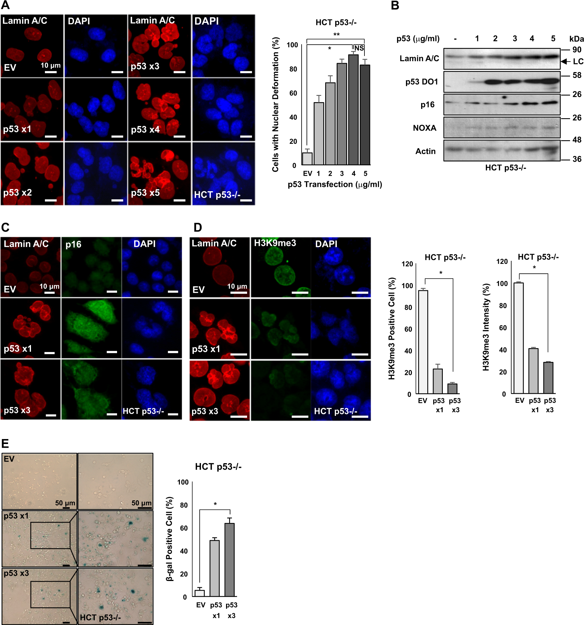 p53 induces senescence through Lamin A/C stabilization-mediated nuclear  deformation | Cell Death & Disease