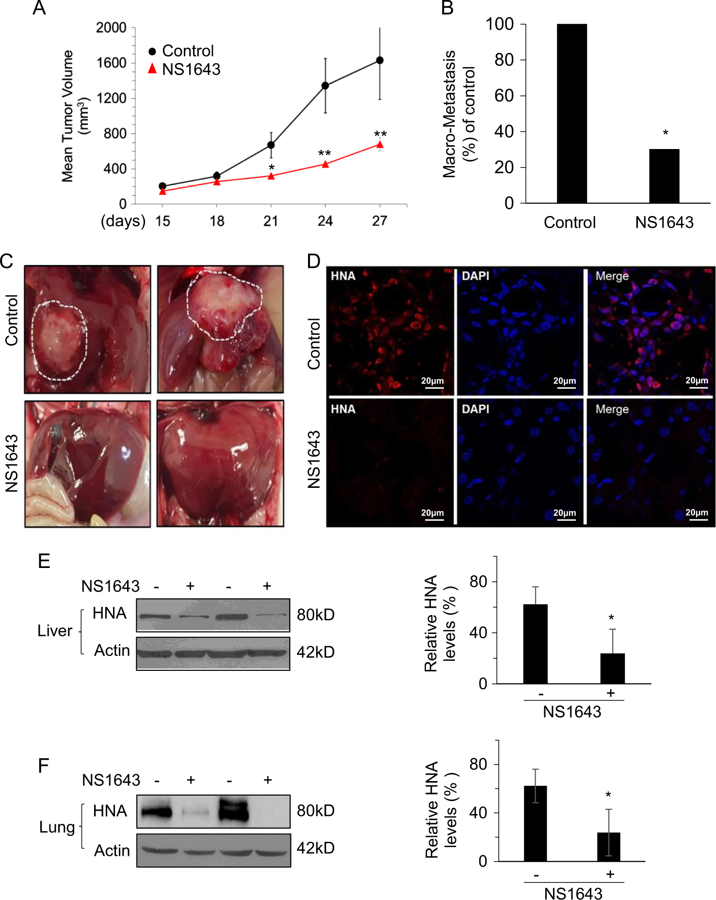 Potassium Channel Activity Controls Breast Cancer Metastasis By Affecting B Catenin Signaling Cell Death Disease