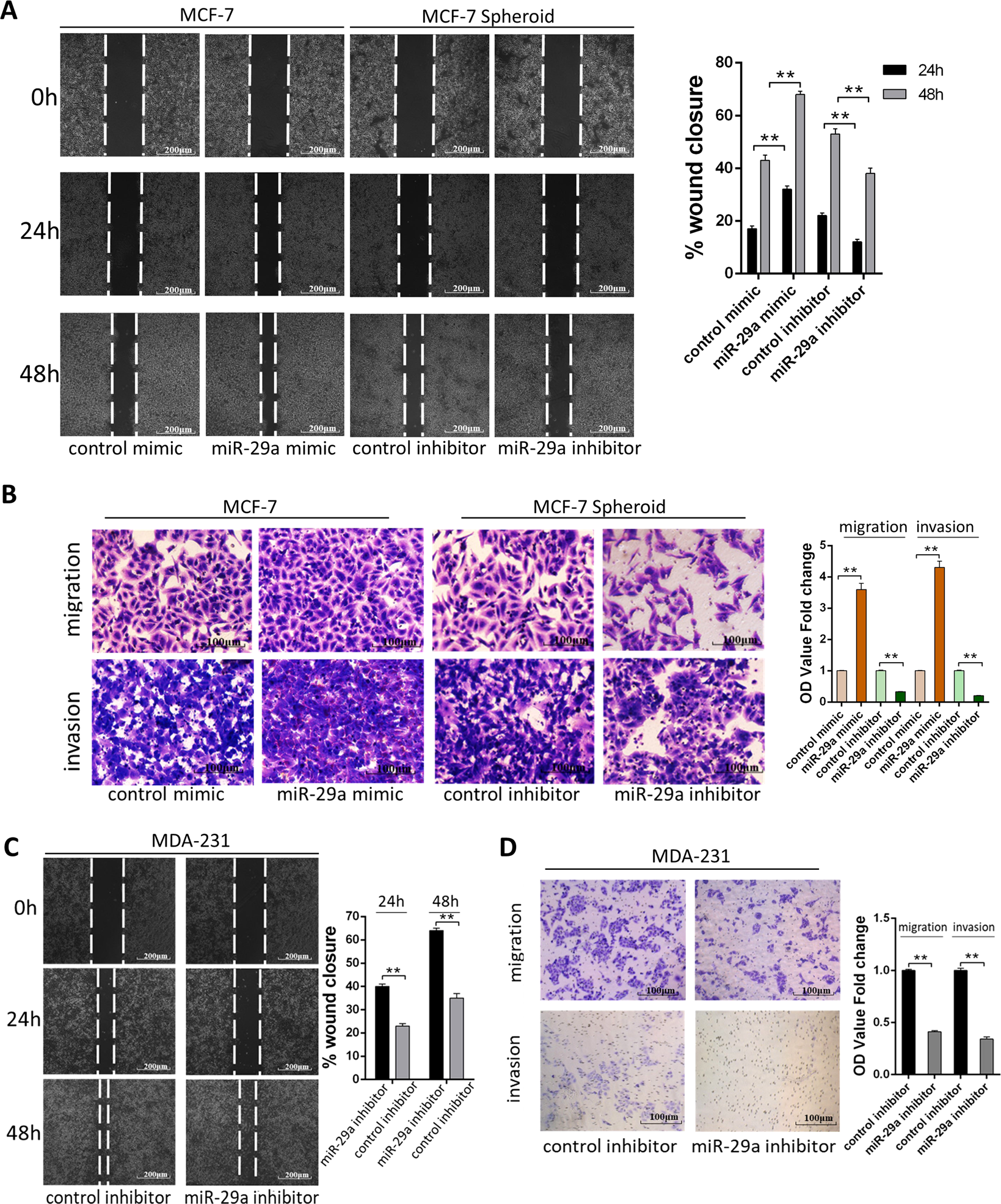Fig. 2: miR-29a promotes breast cancer cells migration and invasion in vitro.