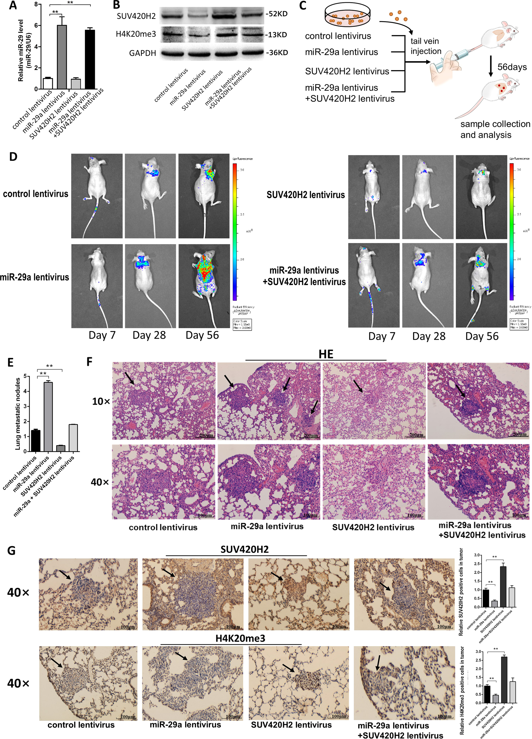 Fig. 7: Effects of SUV420H2-targeted miR-29a on the lung colonization of MCF-7 cells xenografts in mice.
