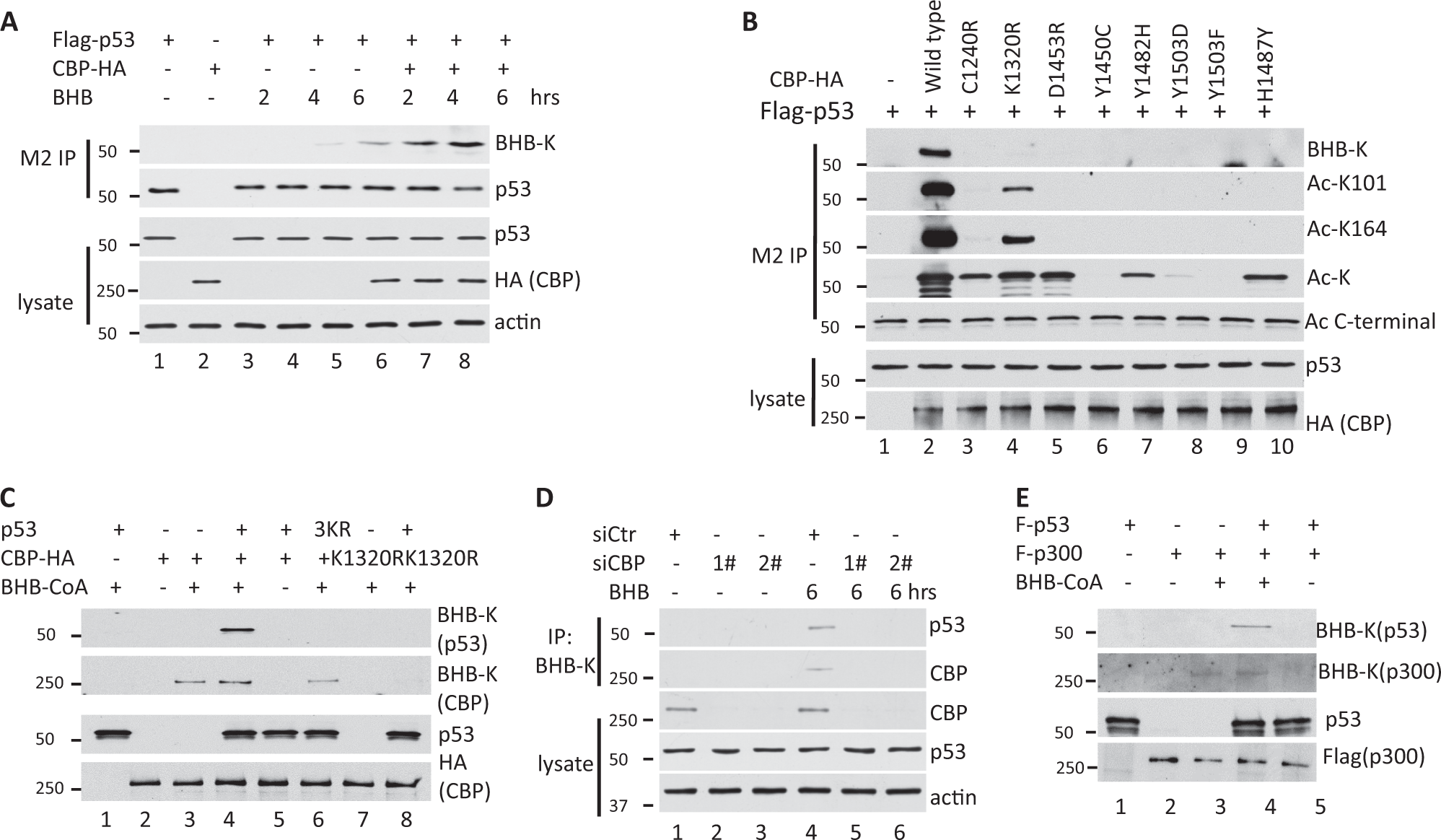 Fig. 2: CBP β-hydroxybutyrylates p53 inside cells and in vitro.