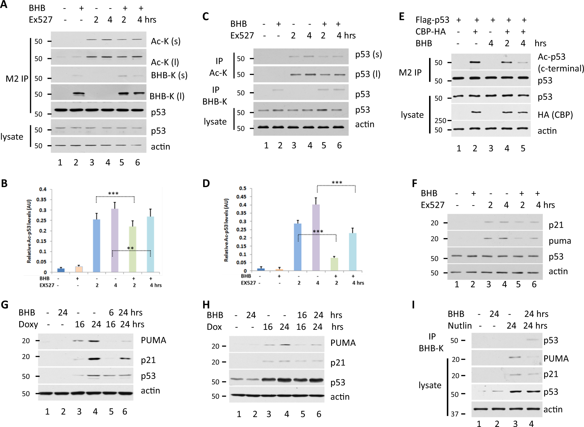Fig. 3: kbhb reduces the acetylation of p53.