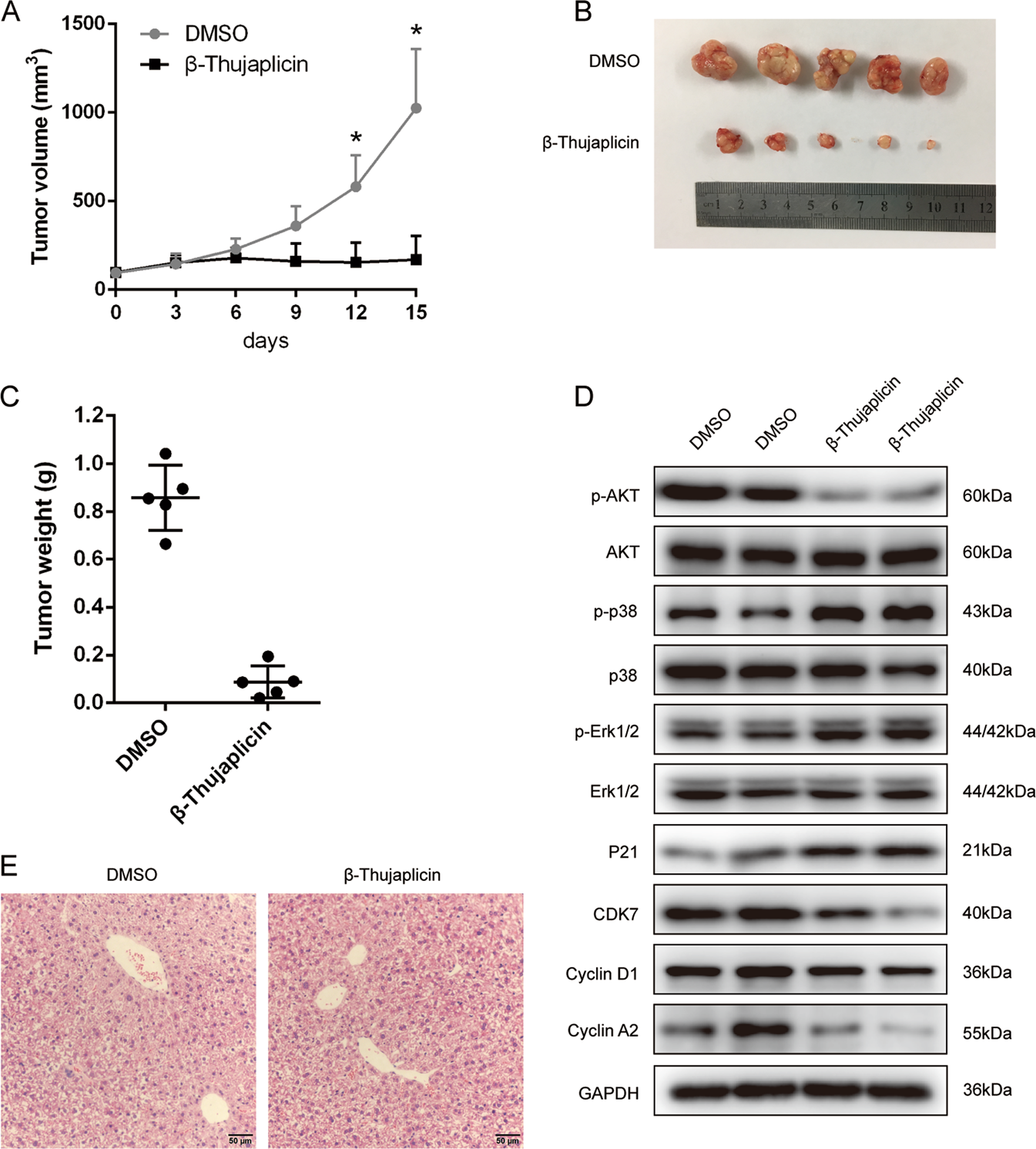 Fig. 5: β-Thujaplicin inhibits tumor growth in xenograft mice.