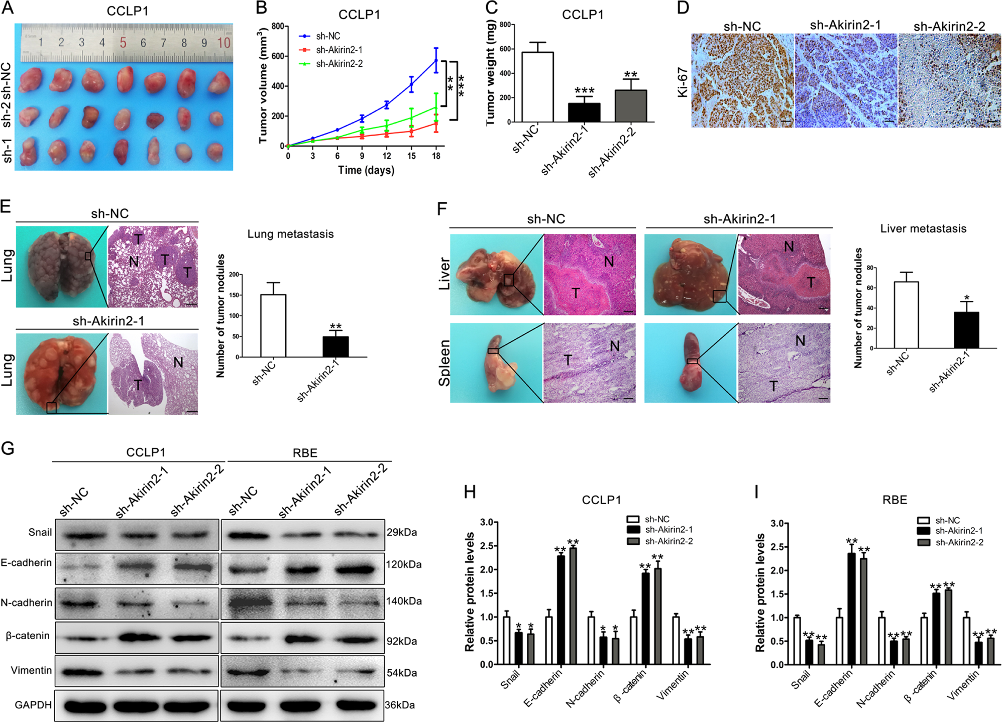Fig. 3: Knockdown of Akirin2 suppresses tumor growth and metastasis in vivo.