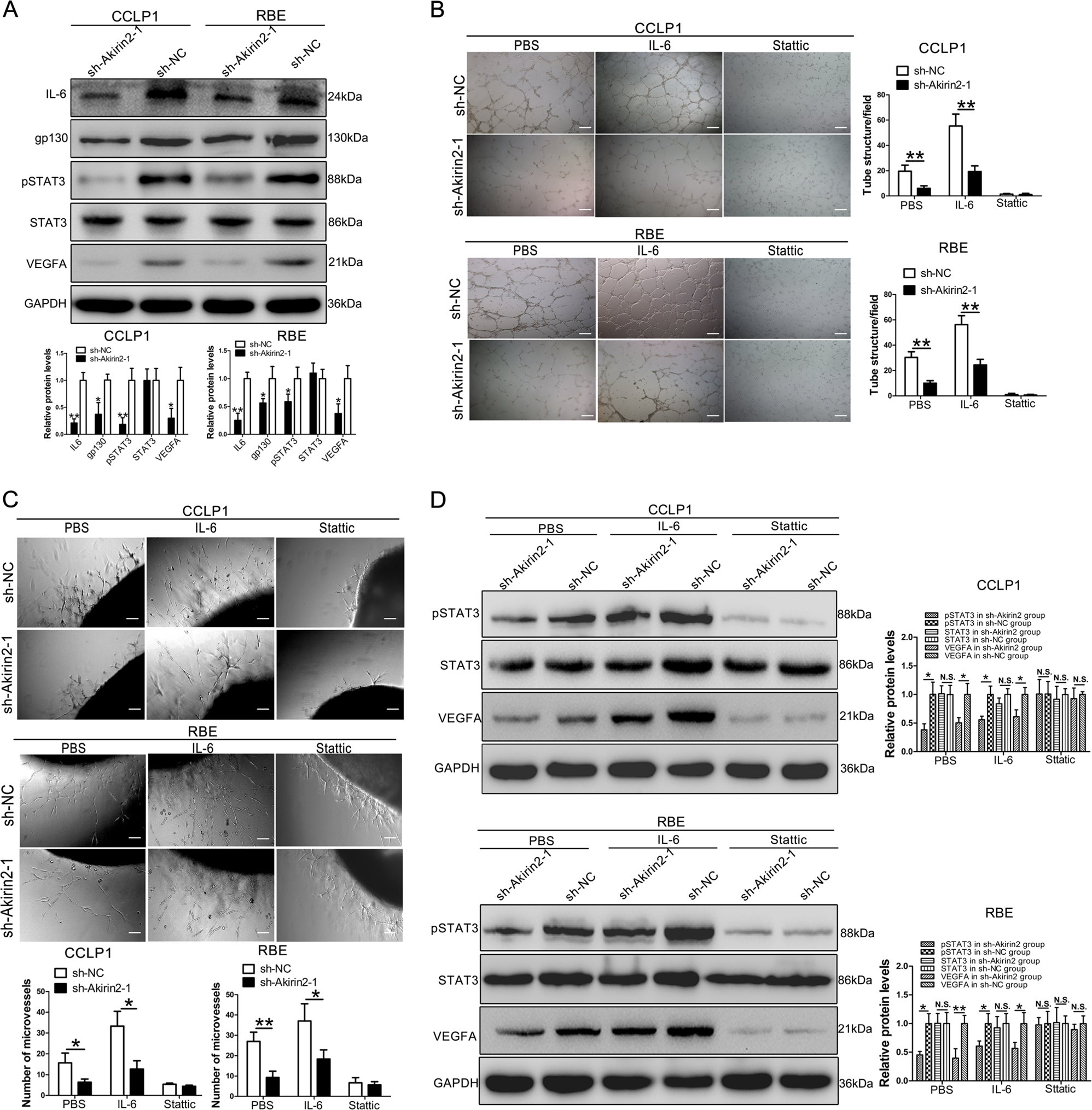 Fig. 5: Akirin2 stimulates VEGFA expression via activating IL-6/STAT3 signaling pathway.