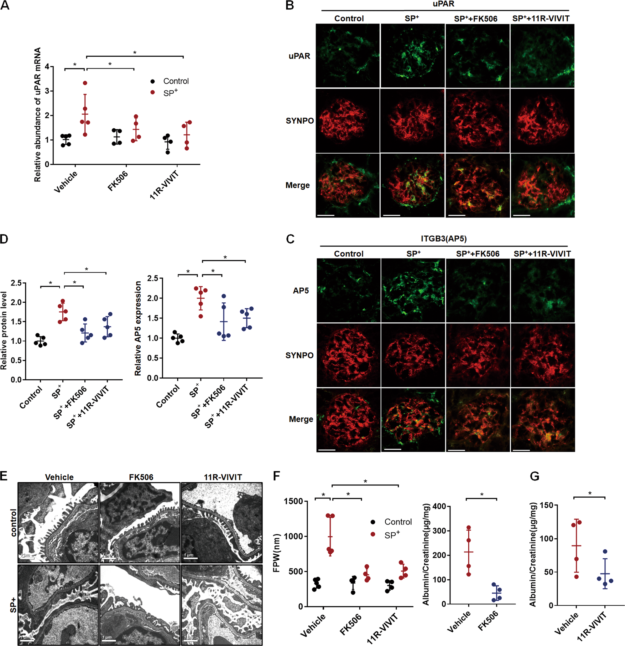 Fig. 2: miR-30 sponge-induced uPAR-ITGB3 activation and podocyte injury were blocked by FK506 and 11R-VIVIT.