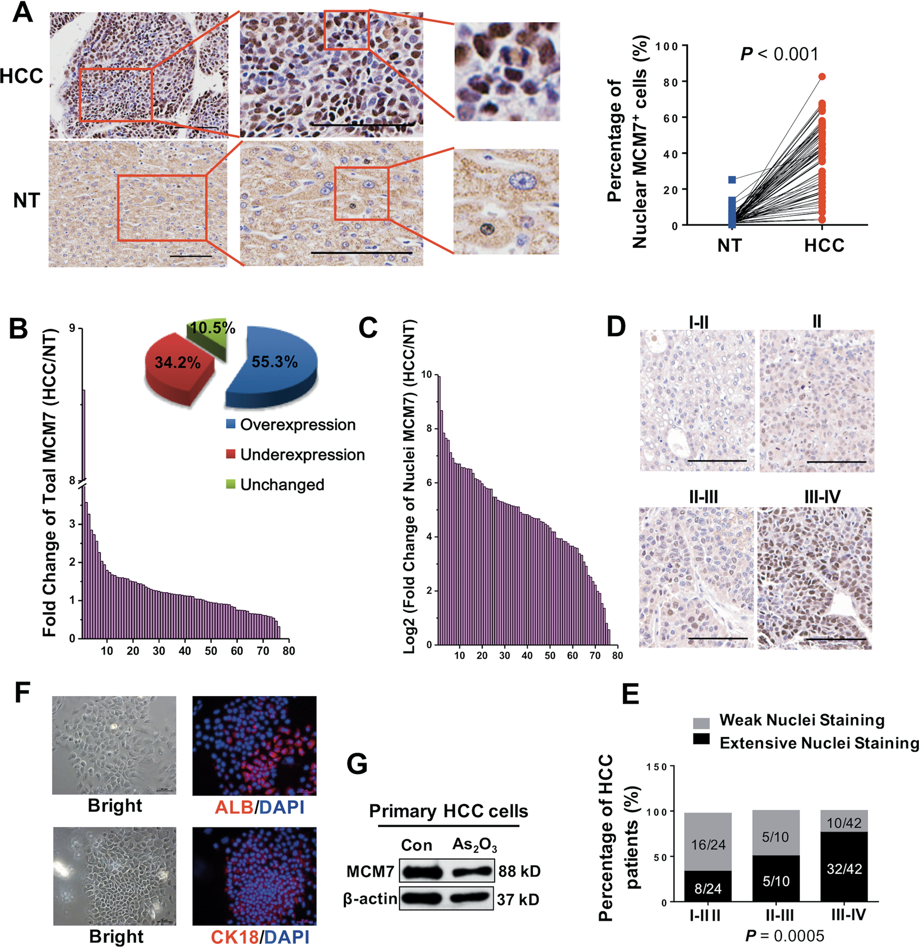 Fig. 5: Correlation analysis of MCM7 and clinical grading in patients.