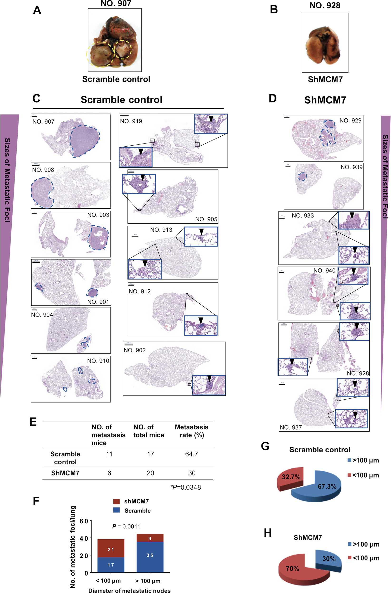 Fig. 7: Effects of MCM7 knockdown on the metastasis capacity of HCC cells in vivo.