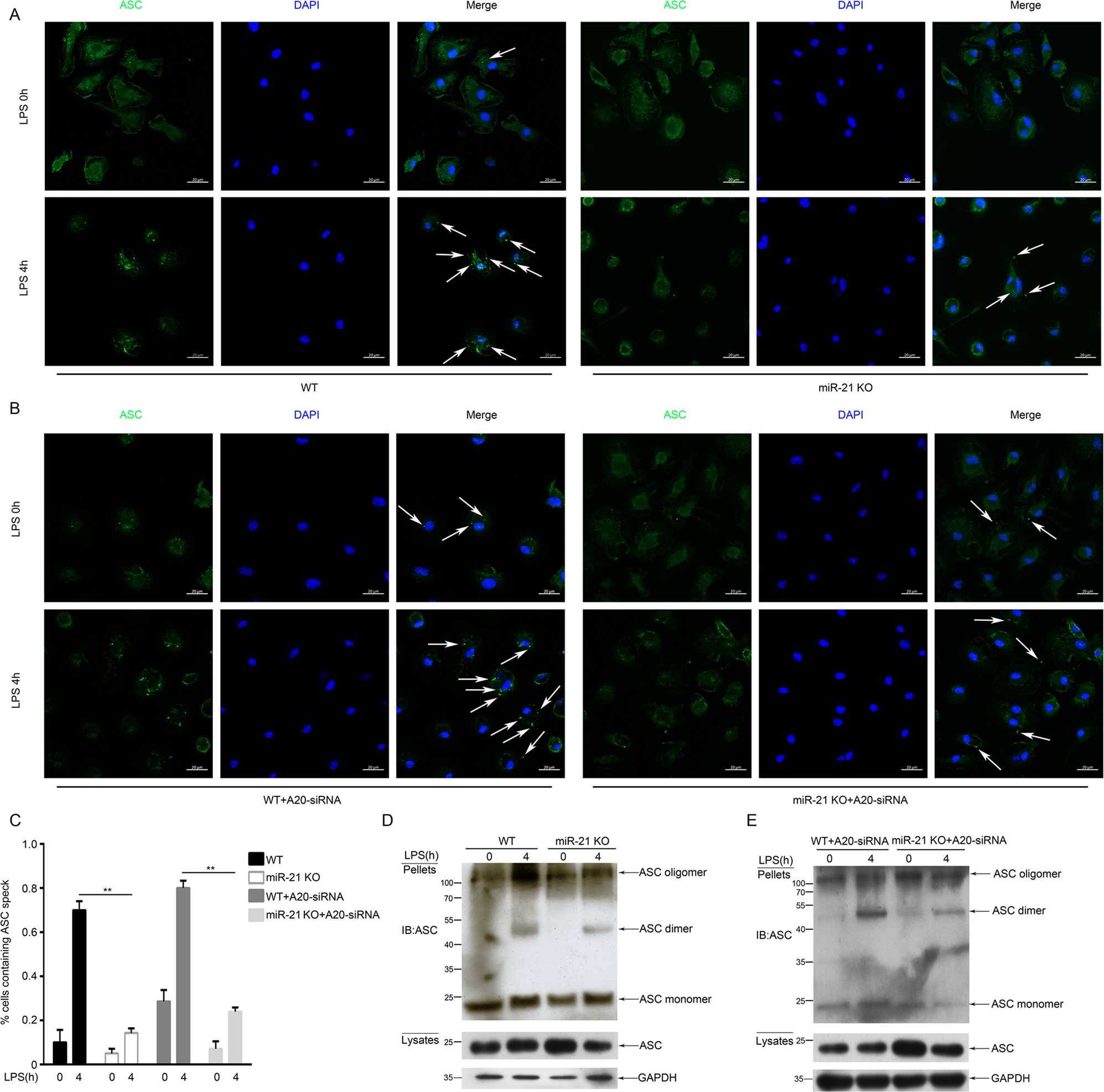 Fig. 4: miR-21 regulates ASC pyroptosome formation.
