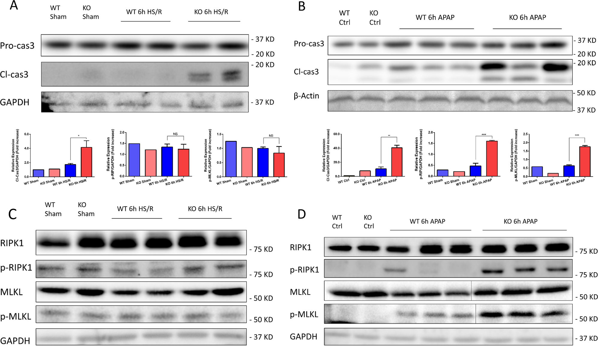 Fig. 3: Western blots of whole-cell lysates from the liver of WT and GsdmD−/− (KO) mice at 6 h after hemorrhagic shock with resuscitation (HS/R) or sham surgery (Sham), or 6 h after acetaminophen overdose (APAP) or controls.