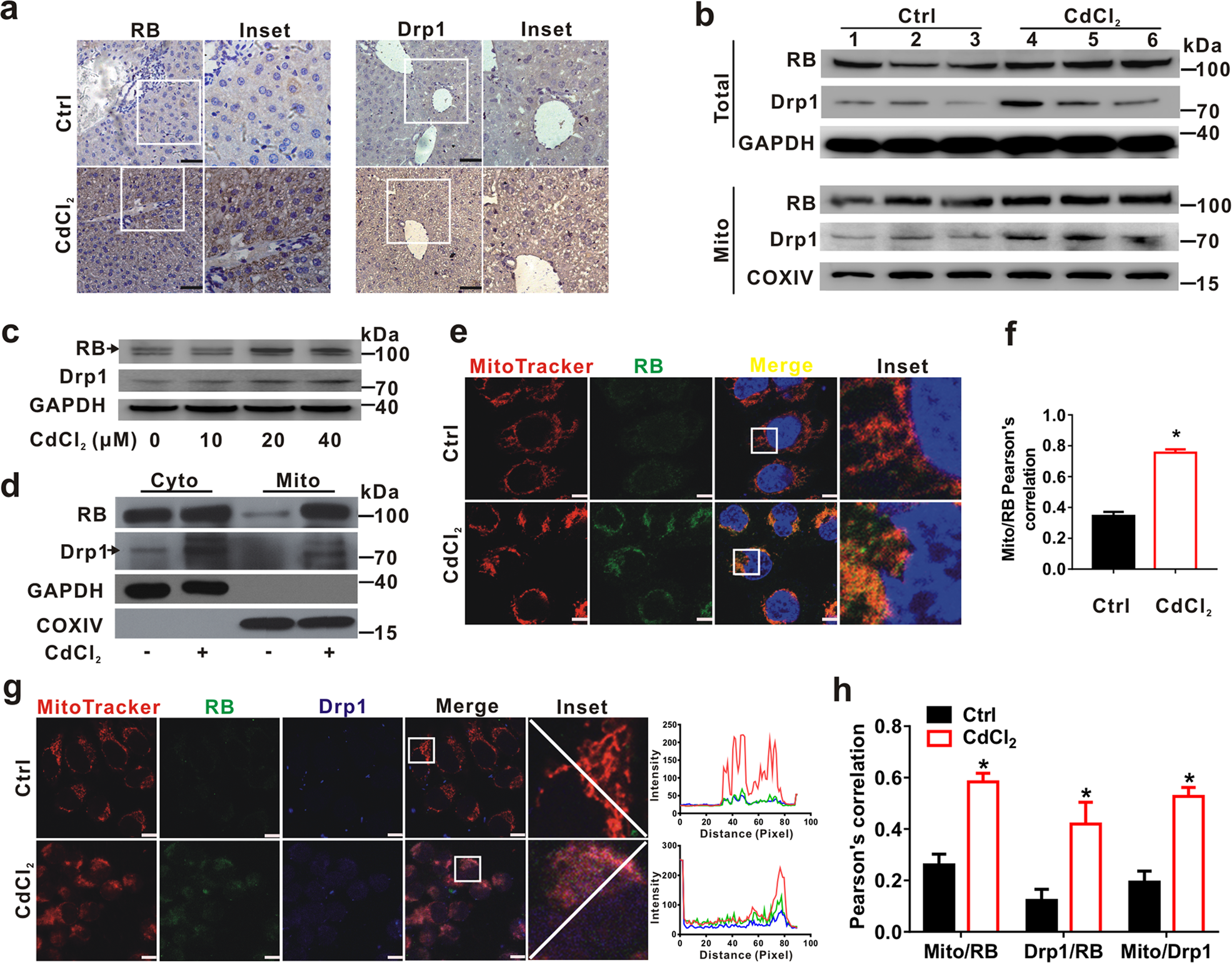 Fig. 5: CdCl2 induces RB expression and its mitochondrial translocation both in vivo and in vitro.