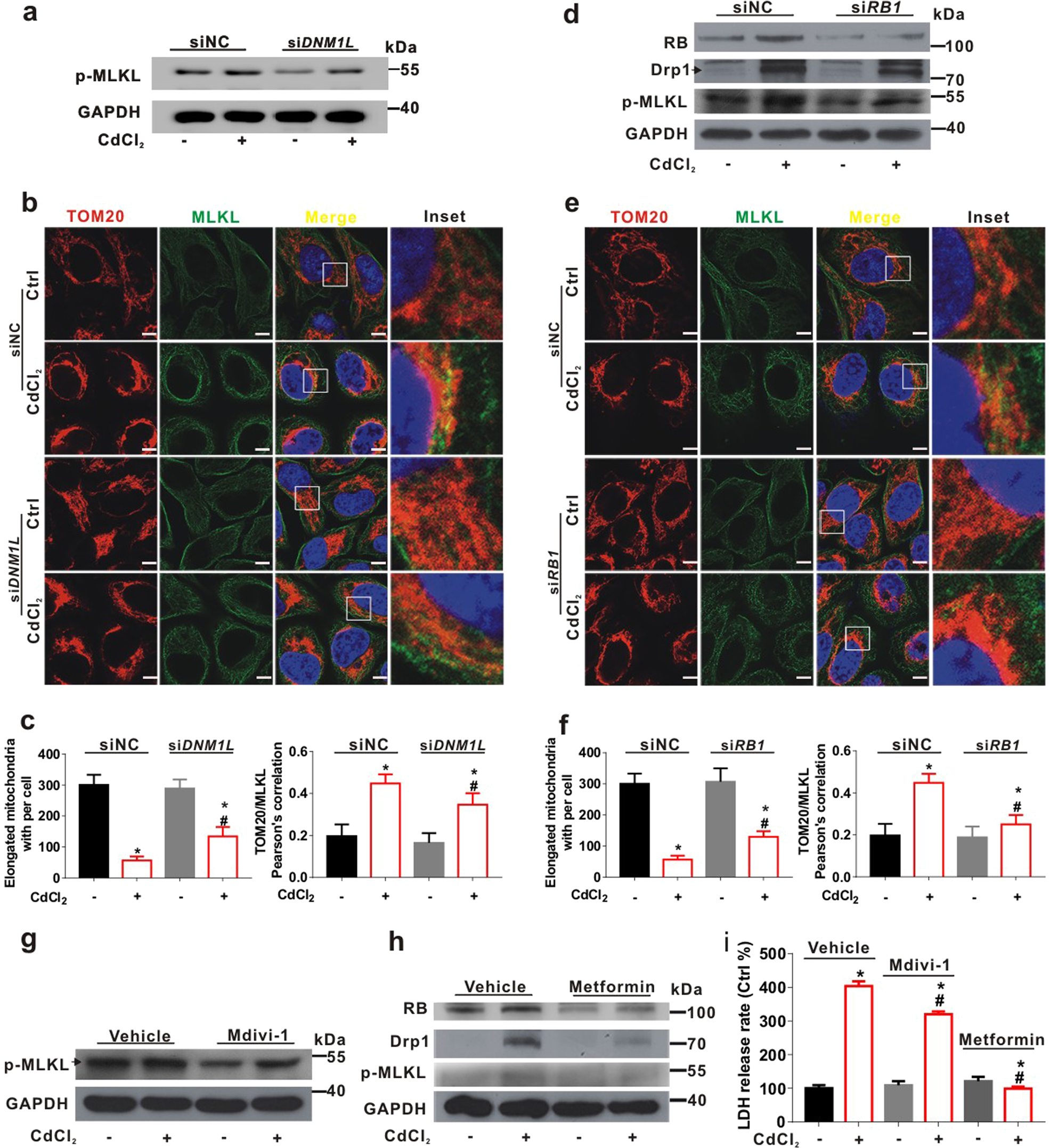 Fig. 7: Drp1-RB axis regulates necroptosis triggered by CdCl2 in L02 cells.
