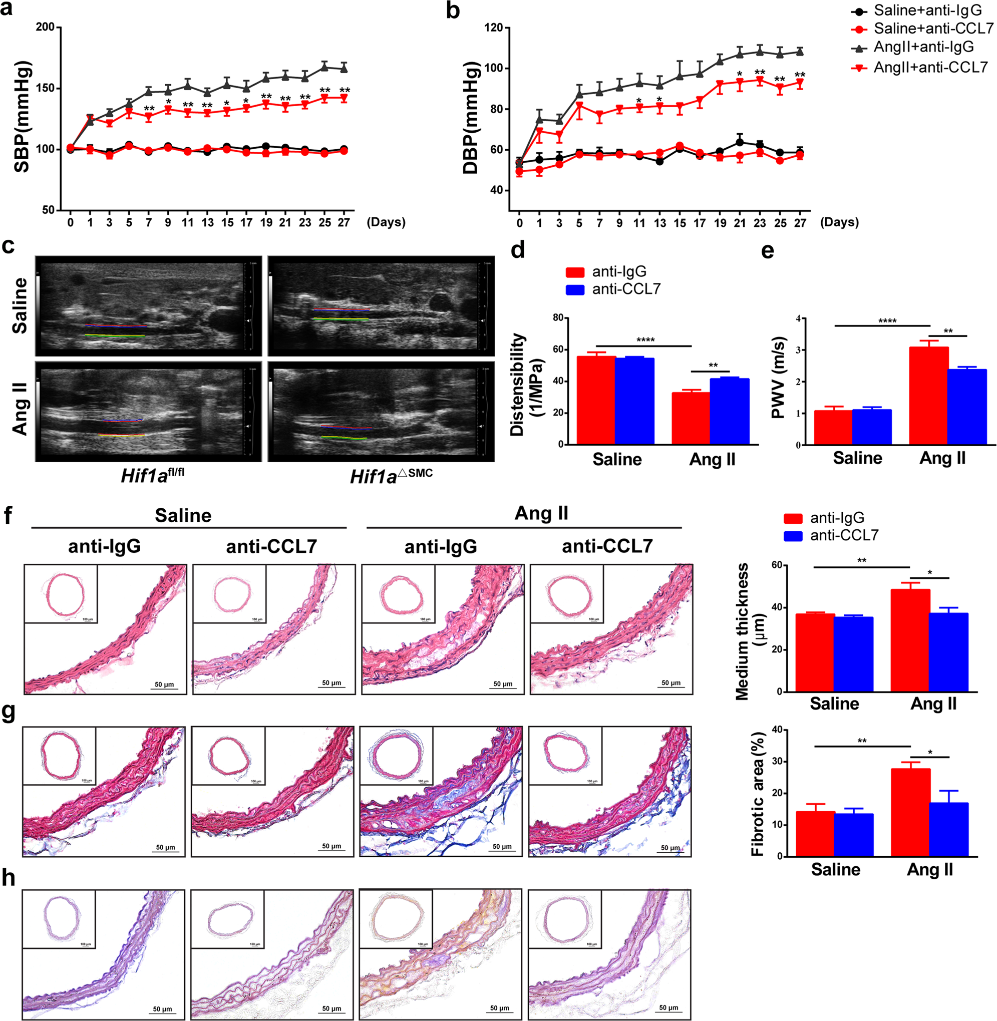 Fig. 6: CCL7 neutralization suppresses Ang II-induced vascular remodeling.