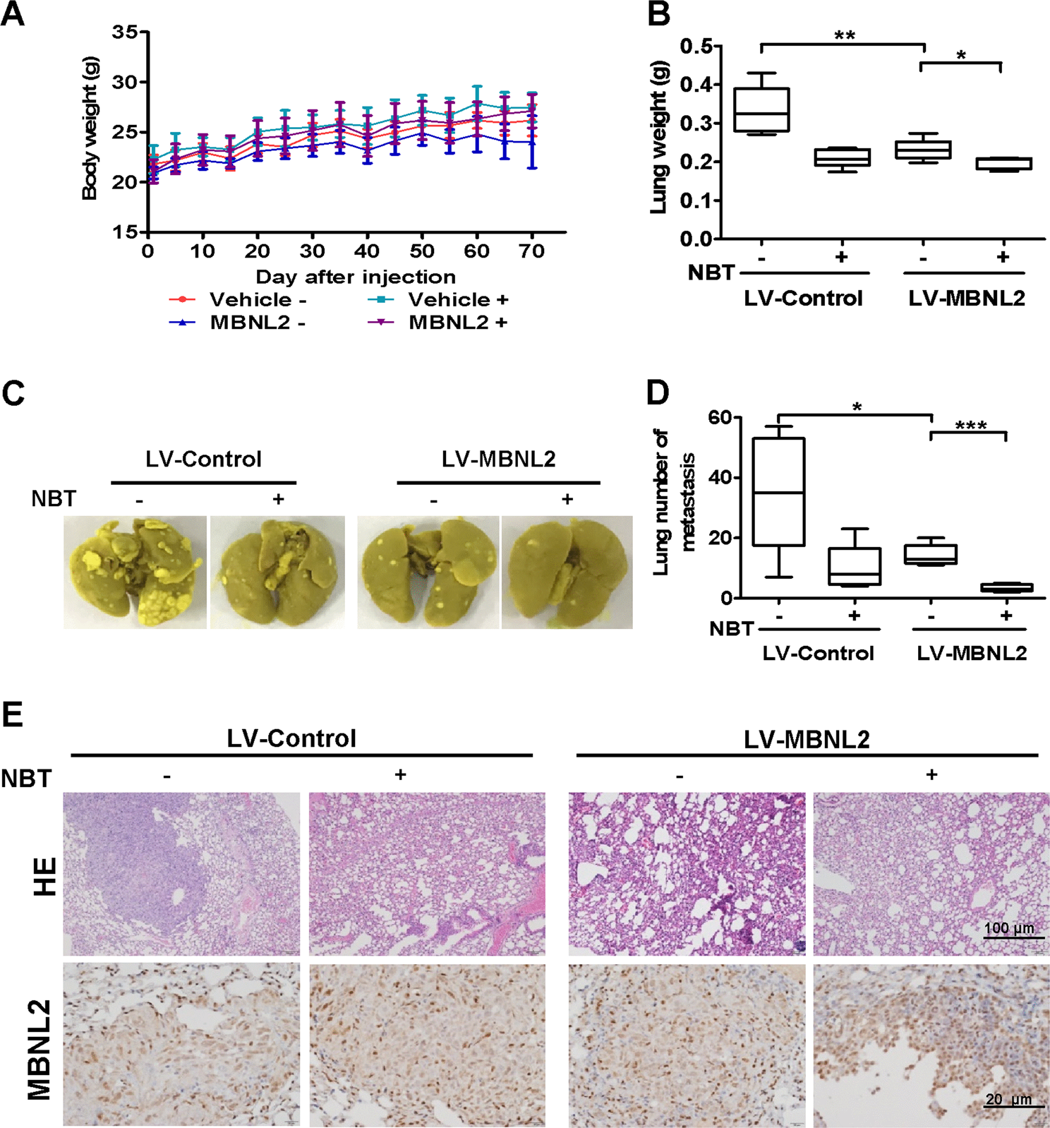 Fig. 7: Overexpression of MBNL2 plus NBT suppresses metastasis in vivo.