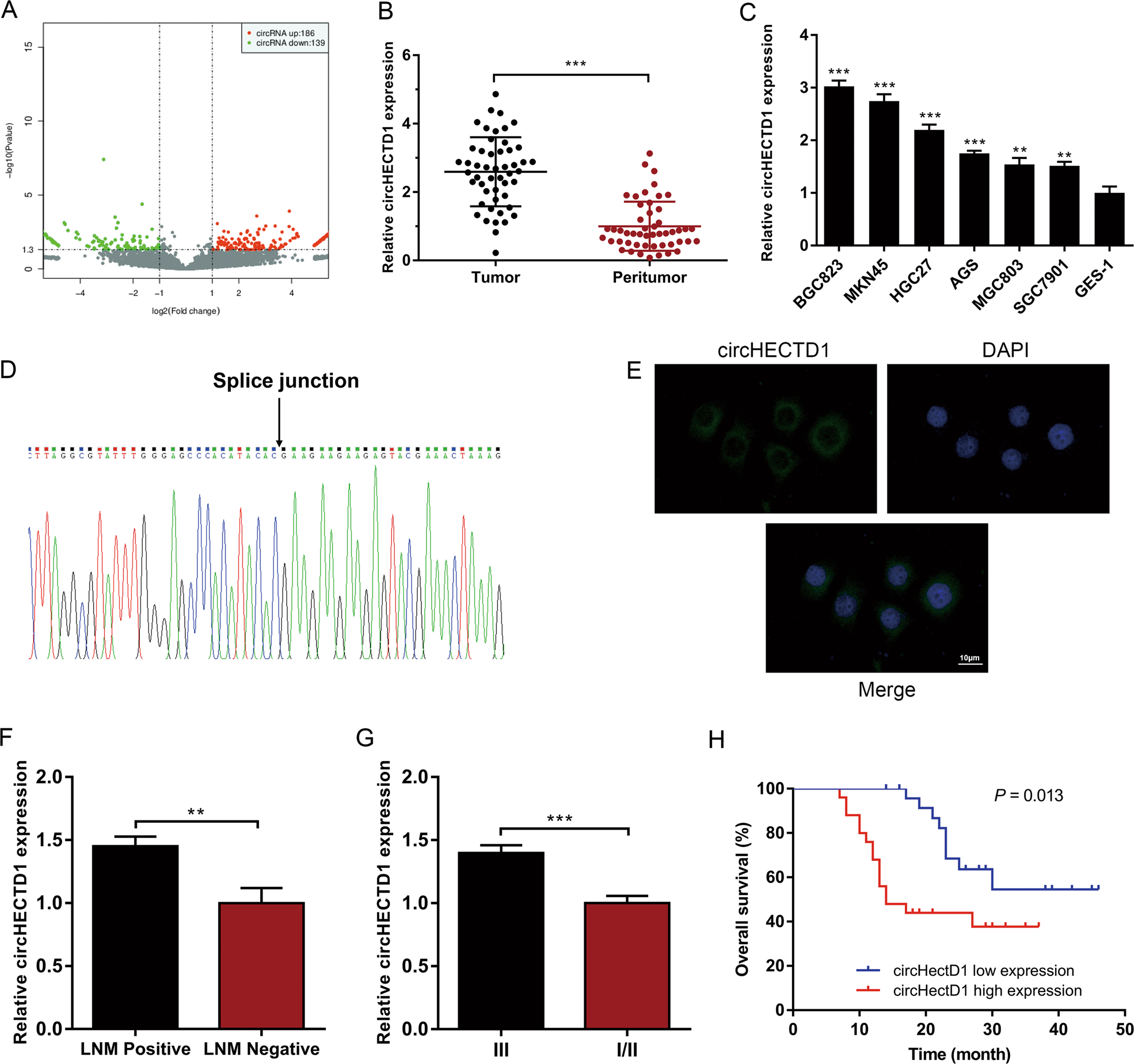 Fig. 1: circHECTD1 is upregulated in gastric cancer (GC) and correlates with unfavorable prognosis.