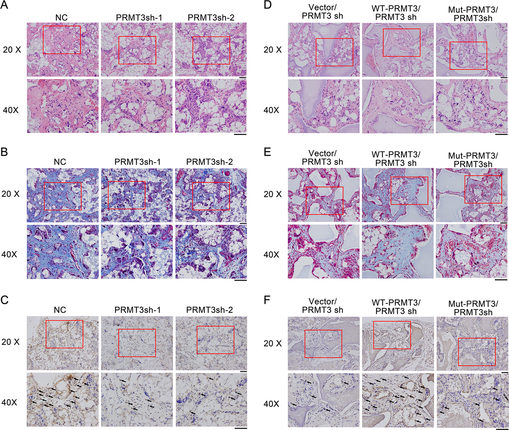 Fig. 3: PRMT3 is a positive regulator of MSC-mediated bone formation in vivo.