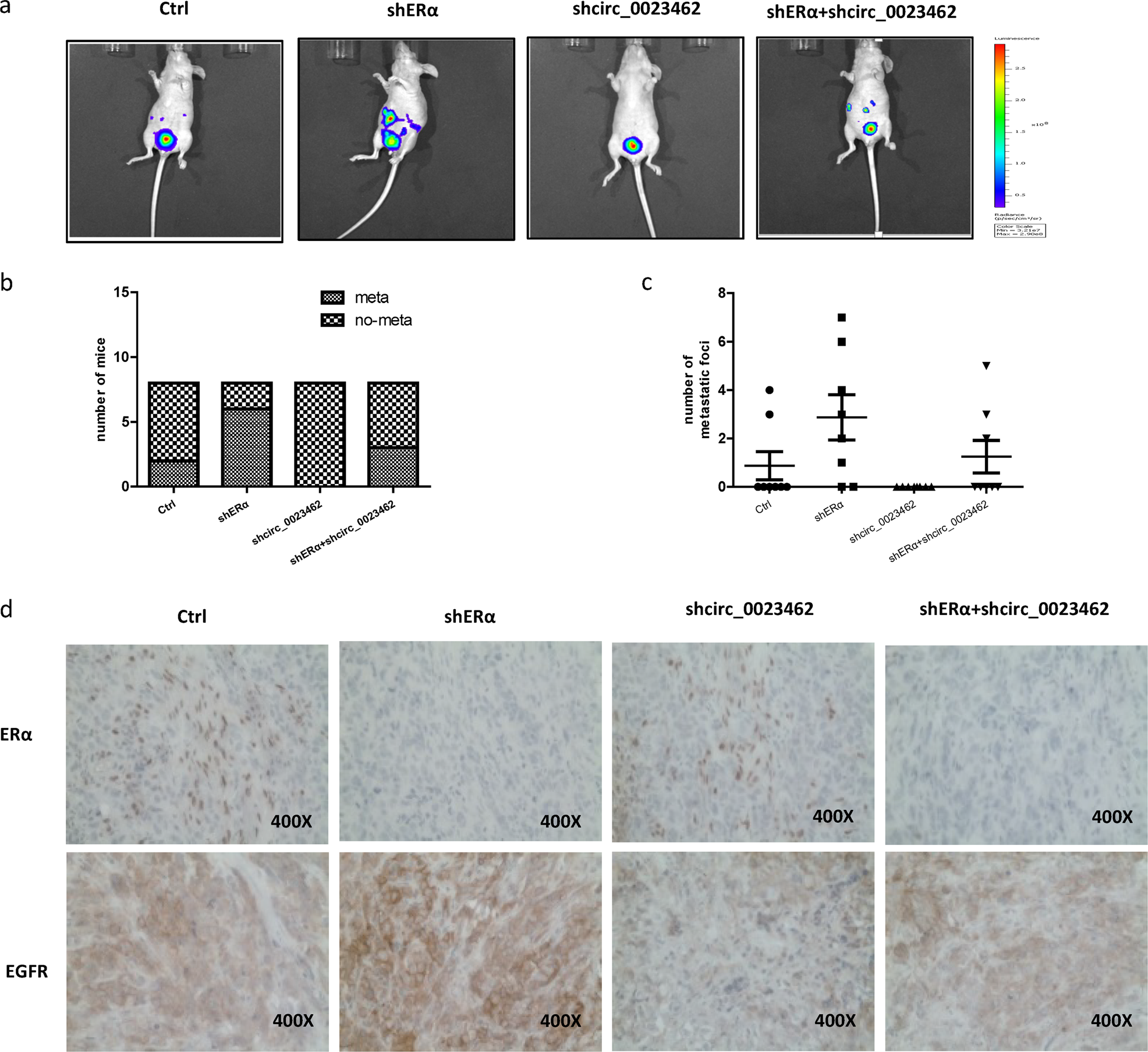 Fig. 6: ERα decreases BCa metastasis by altering circ_0023642 expression in vivo.