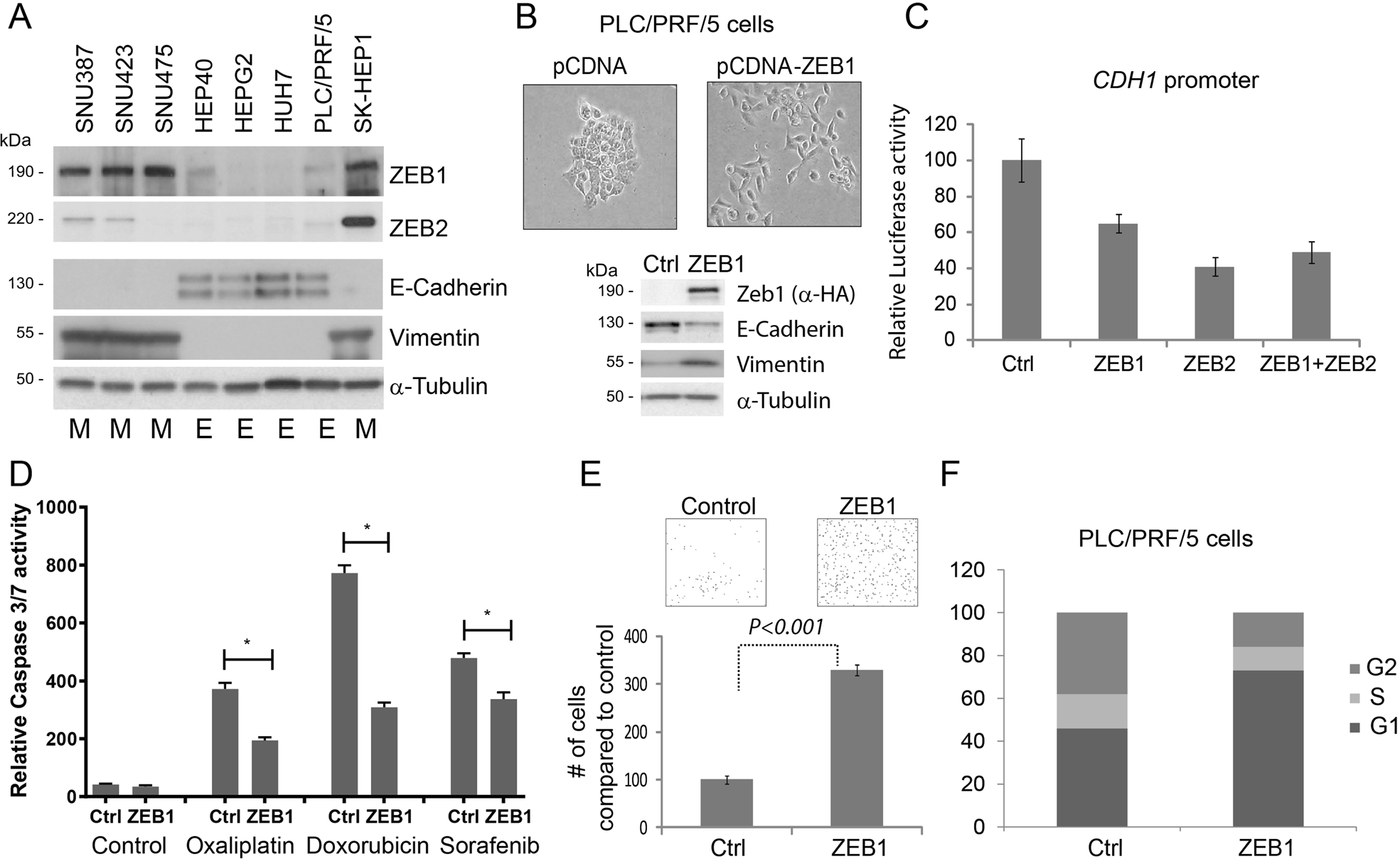 Fig. 2: Transcription factors of ZEB family are expressed in HCC-derived cell lines and contribute to epithelial plasticity.