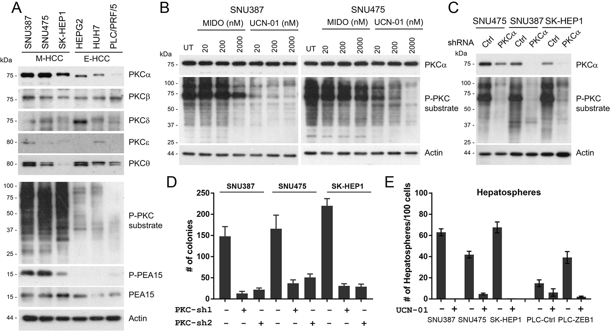 Fig. 6: PKC pathway is activated in M-HCC cells and necessary for M-HCC survival.
