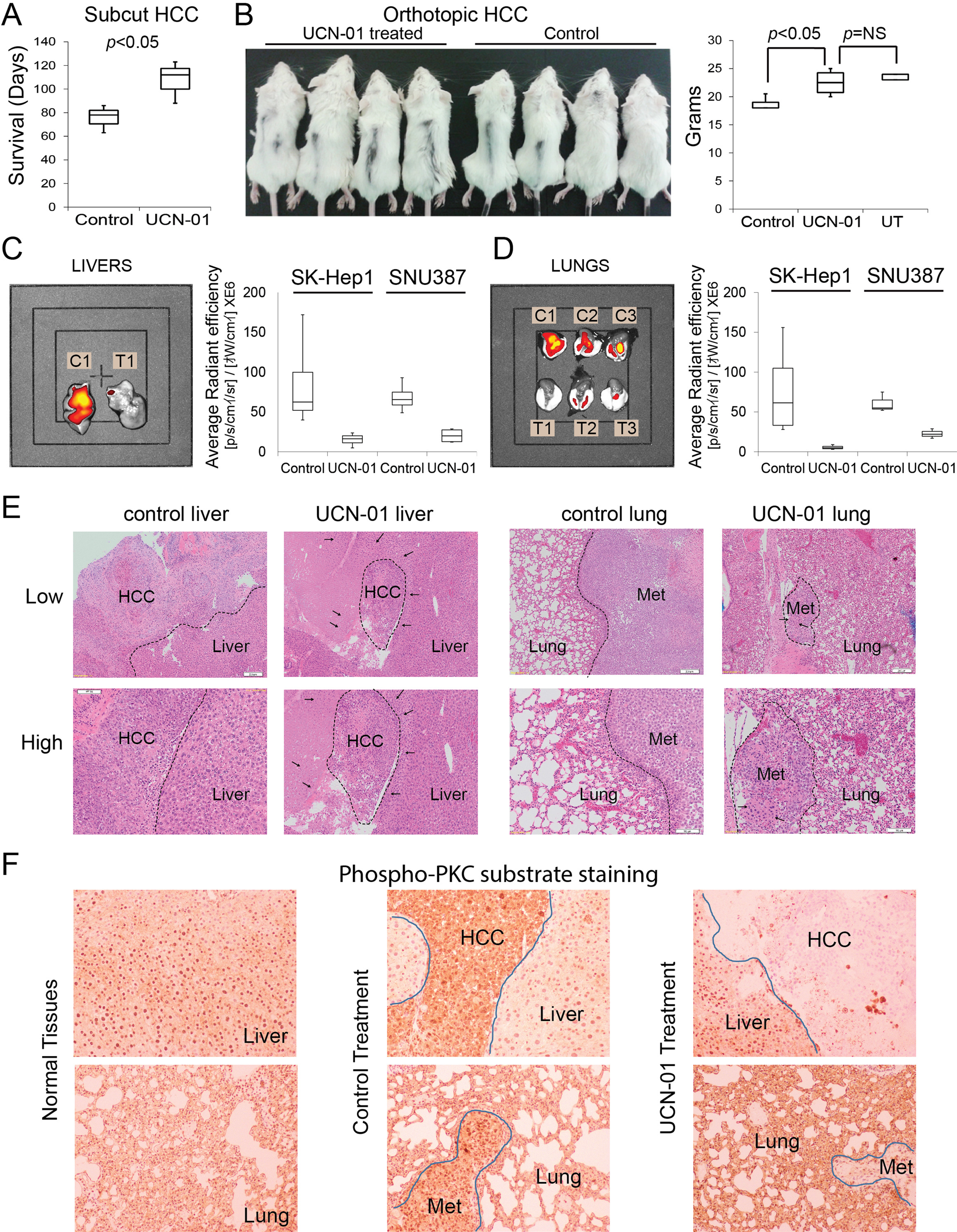 Fig. 8: UCN-01 has in vivo efficacy for metastatic HCC.
