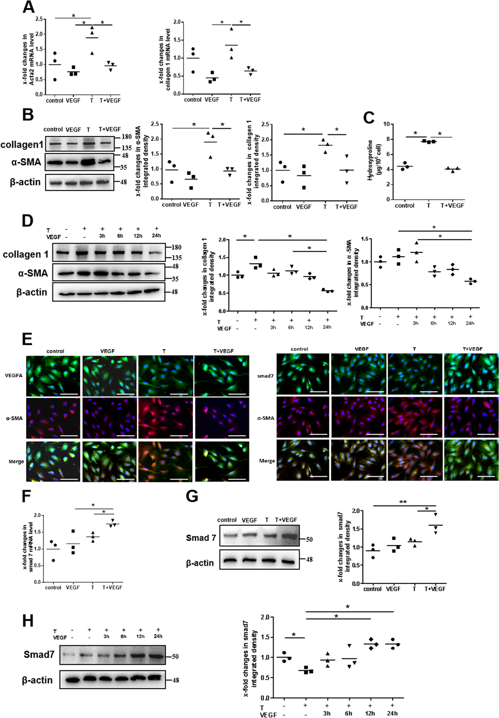 Fig. 4: VEGF165 reverses TGFβ1-stimulated fibrotic gene expression and increased smad7 expression in endometrial stromal cells.