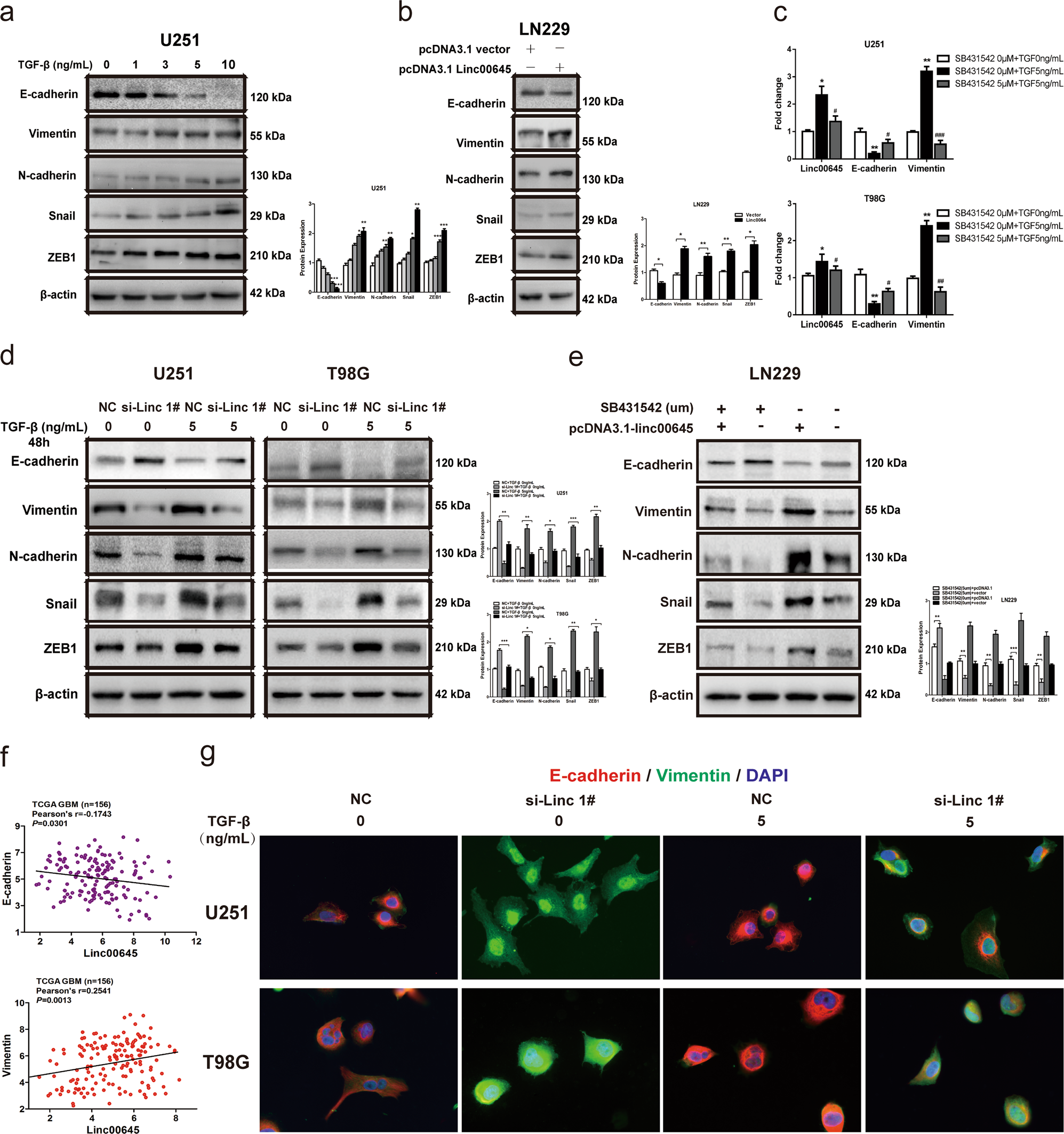Fig. 3: Linc00645 was required for epithelial mesenchymal transition in glioma cells.