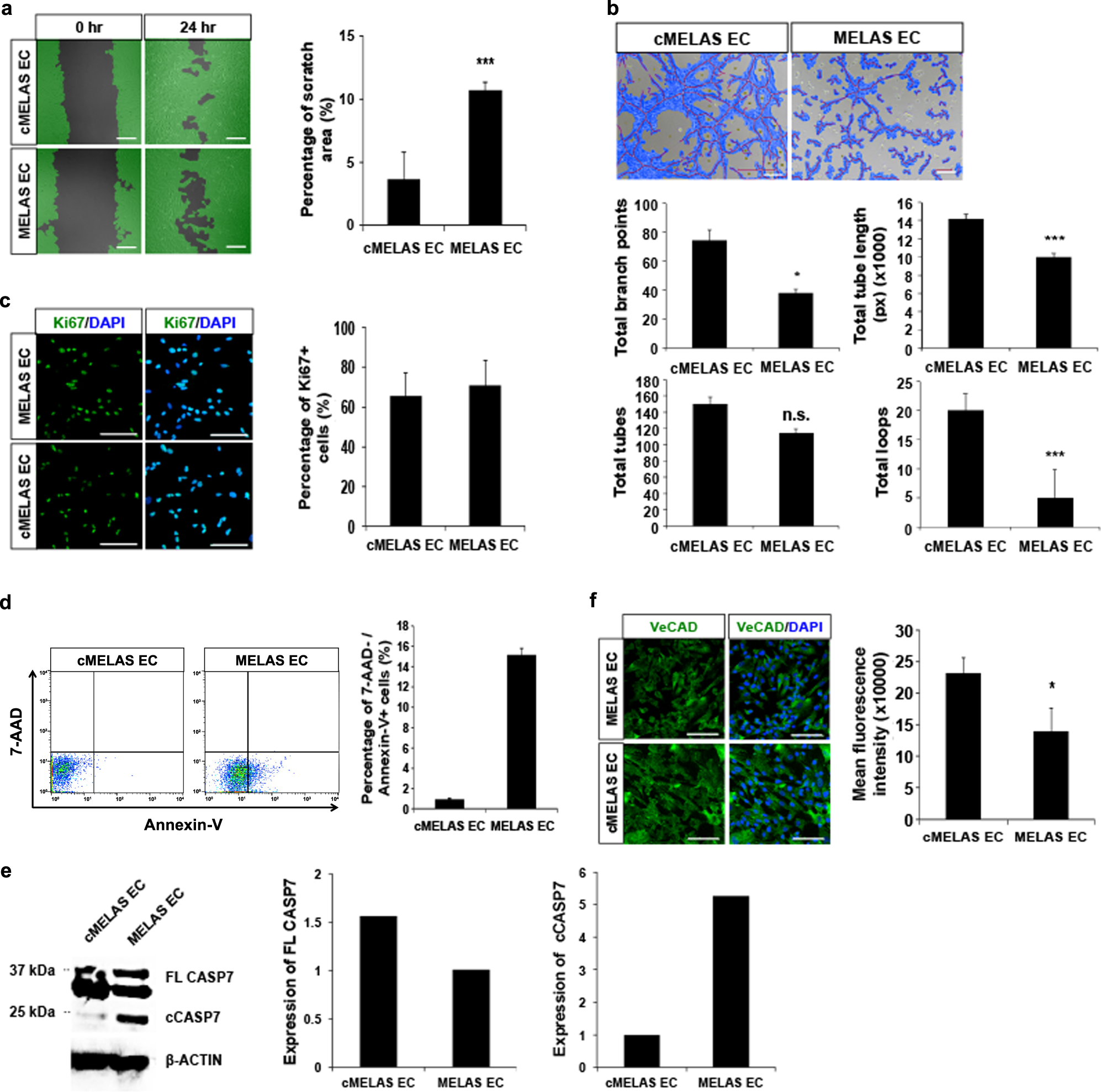 Fig. 3: MELAS ECs exhibit functional defects.