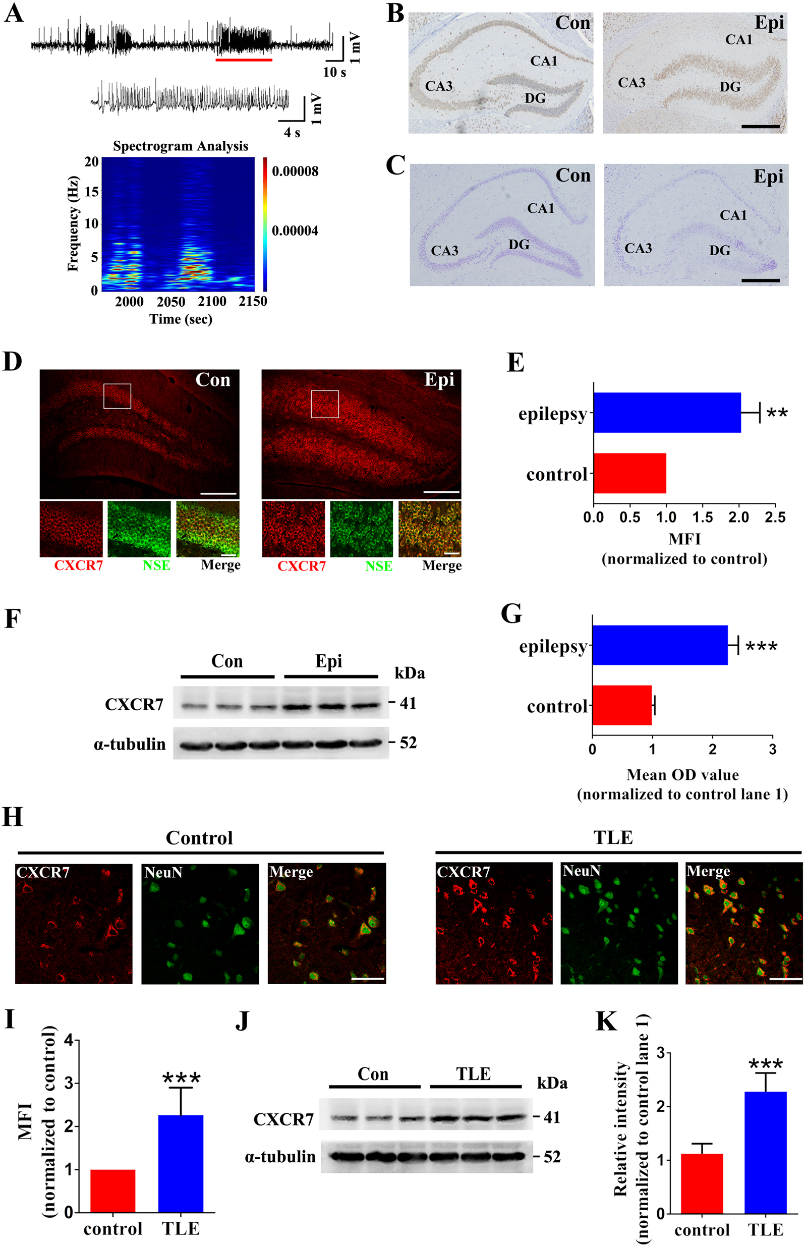 Fig. 1: Verification of the mouse model of intrahippocampal KA-induced epilepsy (a–c) and the pattern of CXCR7 expression in the mouse model of epilepsy and in patients with TLE (d–k)