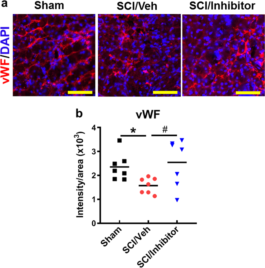 Fig. 5: Central administration of miR-711 hairpin inhibitor results in significant SCI-induced disinhibition of vascular density labeled with endothelial marker von Willebrand factor (vWF, red).