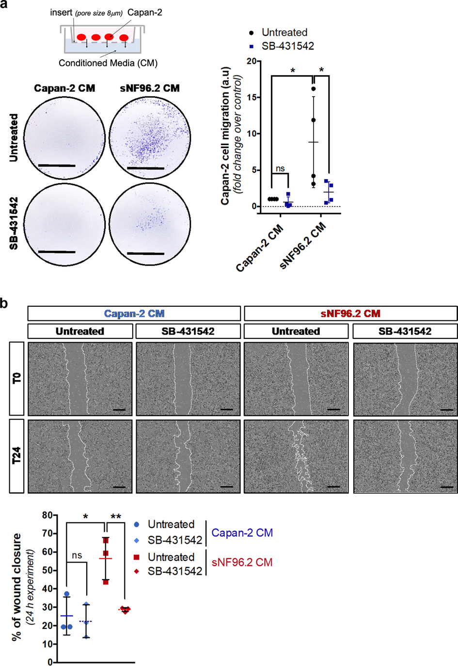 Fig. 3: Secreted factors from sNF96.2 cells stimulate Capan-2 cell migration in a TGFβ-dependent manner.