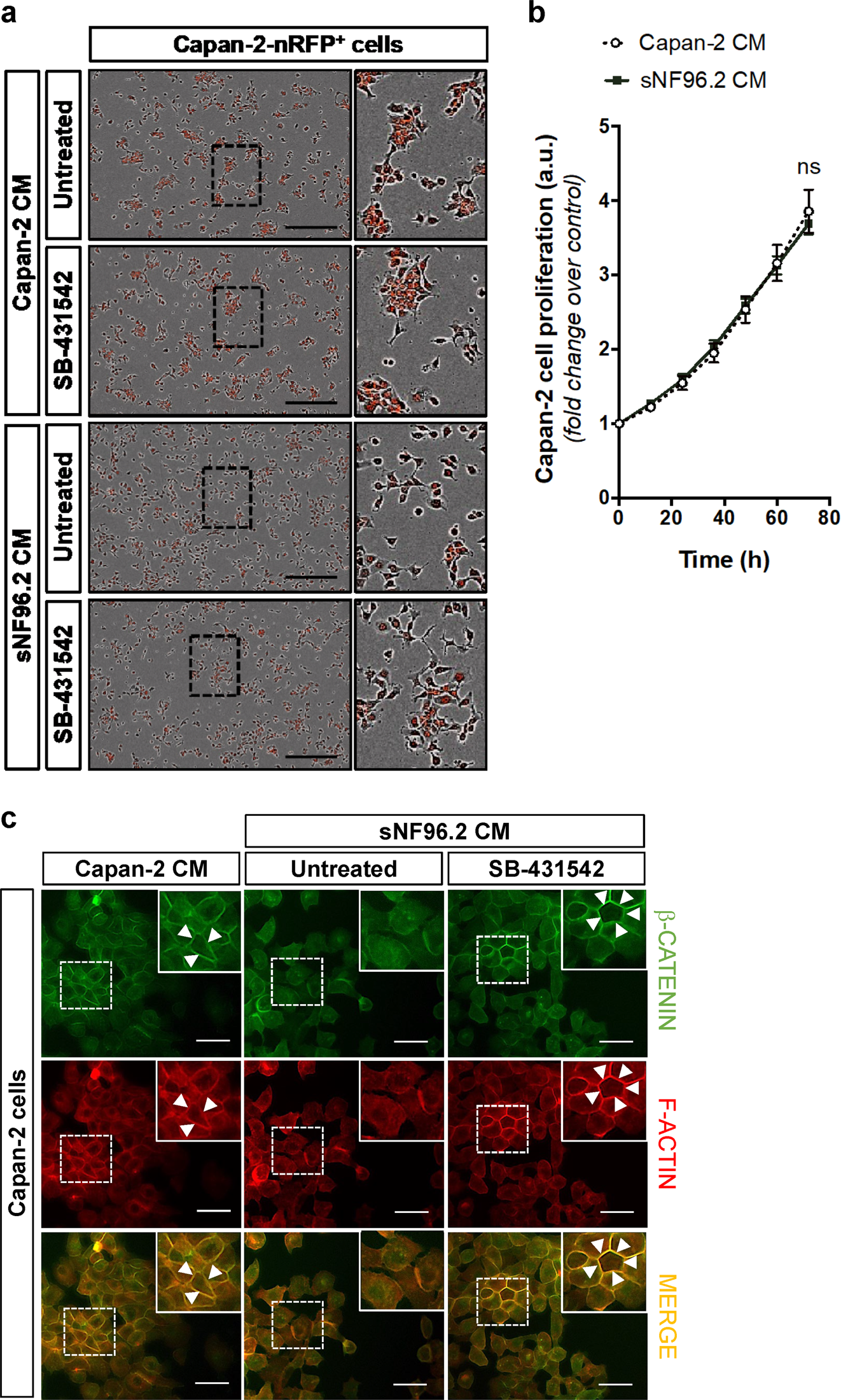 Fig. 4: Secreted factors from sNF96.2 cells modulate Capan-2 cell–cell interactions in a TGFβ-dependent manner.